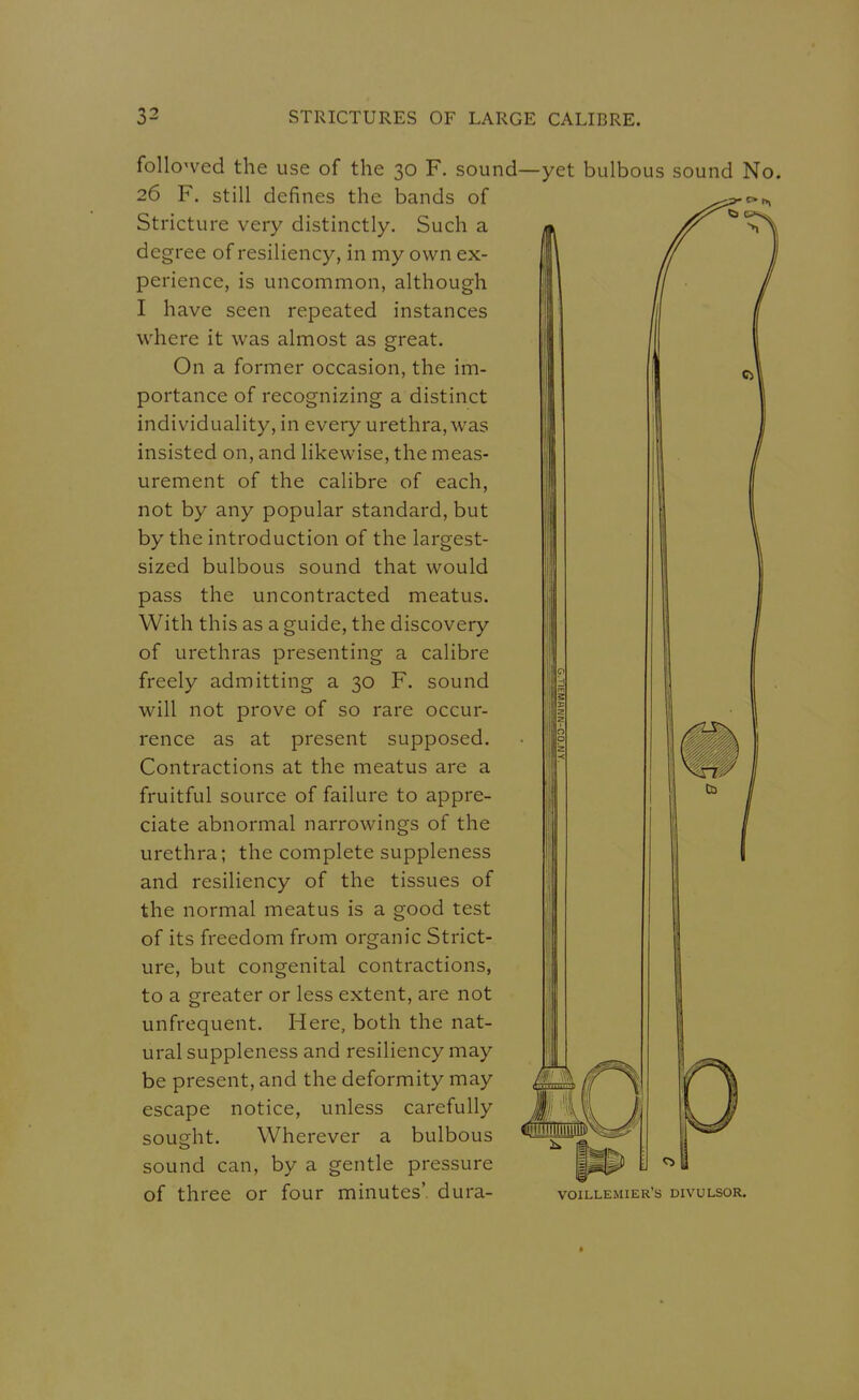 follo'ved the use of the 30 F. sound—yet bulbous sound No. 26 F. still defines the bands of Stricture very distinctly. Such a degree of resiliency, in my own ex- perience, is uncommon, although I have seen repeated instances where it was almost as great. On a former occasion, the im- portance of recognizing a distinct individuality, in every urethra, was insisted on, and likewise, the meas- urement of the calibre of each, not by any popular standard, but by the introduction of the largest- sized bulbous sound that would pass the uncontracted meatus. With this as a guide, the discovery of urethras presenting a calibre freely admitting a 30 F. sound will not prove of so rare occur- rence as at present supposed. Contractions at the meatus are a fruitful source of failure to appre- ciate abnormal narrowings of the urethra; the complete suppleness and resiliency of the tissues of the normal meatus is a good test of its freedom from organic Strict- ure, but congenital contractions, to a greater or less extent, are not unfrequent. Here, both the nat- ural suppleness and resiliency may be present, and the deformity may escape notice, unless carefully sousfht. Wherever a bulbous sound can, by a gentle pressure of three or four minutes', dura- voillemier's divulsor.