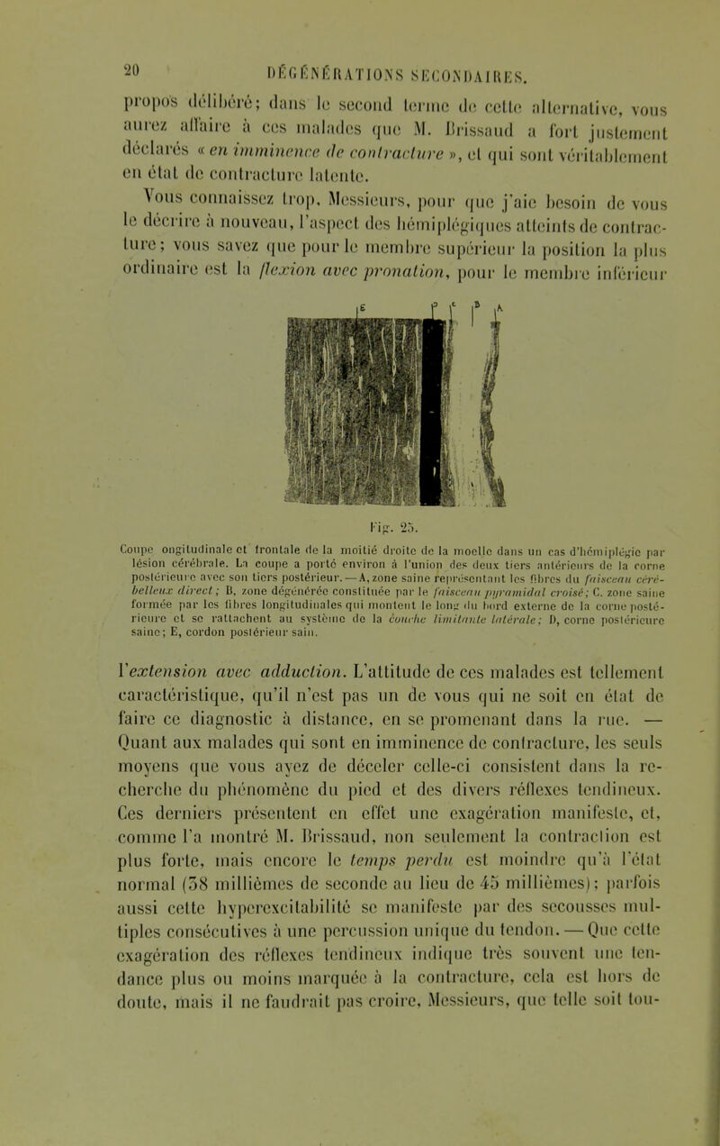 propos délibéré; dans le second terme de cette alternative, vous aurez allairc à ces malades que M. Jirissaud a fort justement déclarés « en imminence de contracture », et qui sont véritablement en état de contracture latente. Vous connaissez trop, Messieurs, pour que j'aie besoin de vous le décrire à nouveau, l'aspect des hémiplégiques atteints de contrac- ture; vous savez que pour le membre supérieur la position la plus ordinaire est la flexion avec pronation, pour le membre inférieur Kip. 25. Coupe ongitudinale et frontale de la moitié droite de la moelle dans un cas d'hcmipléfîie par lésion cérébrale. Li coupe a porte environ à l'union des deux tiers antérieurs de la corne postérieure avec son tiers postérieur. —A, zone saine représentant les fibres du faisceau céré- belleux direct; B, zone dégénérée constituée par le faisceau pyramidal croisé; G. zone formée par les libres longitudinales qui montent le long du bord externe de la corne posté- rieure et se rattachent au système de la couche limitante latérale ; D, corne postérieure saine; E, cordon postérieur sain. Yextension avec adduction. L'attitude de ces malades est tellement caractéristique, qu'il n'est pas un de vous qui ne soit en état de faire ce diagnostic à distance, en se promenant dans la rue. — Quant aux malades qui sont en imminence de conlraclure, les seuls moyens que vous ayez de déceler celle-ci consistent dans la re- cherche du phénomène du pied et des divers réflexes tendineux. Ces derniers présentent en effet une exagération manifeste, et, comme l'a montré M. lirissaud, non seulement la contraclion esl plus forte, mais encore le temps perdu est moindre qu'à l'étal normal (38 millièmes de seconde au lieu de 45 millièmes); parfois aussi cette hyperexcitabilité se manifeste par des secousses mul- tiples consécutives à une percussion unique du tendon. — Que cette exagération des réflexes tendineux indique très souvenl une ten- dance plus ou moins marquée à la contracture, cela est hors de doute, mais il né faudrait pas croire, Messieurs, que telle soil tou-