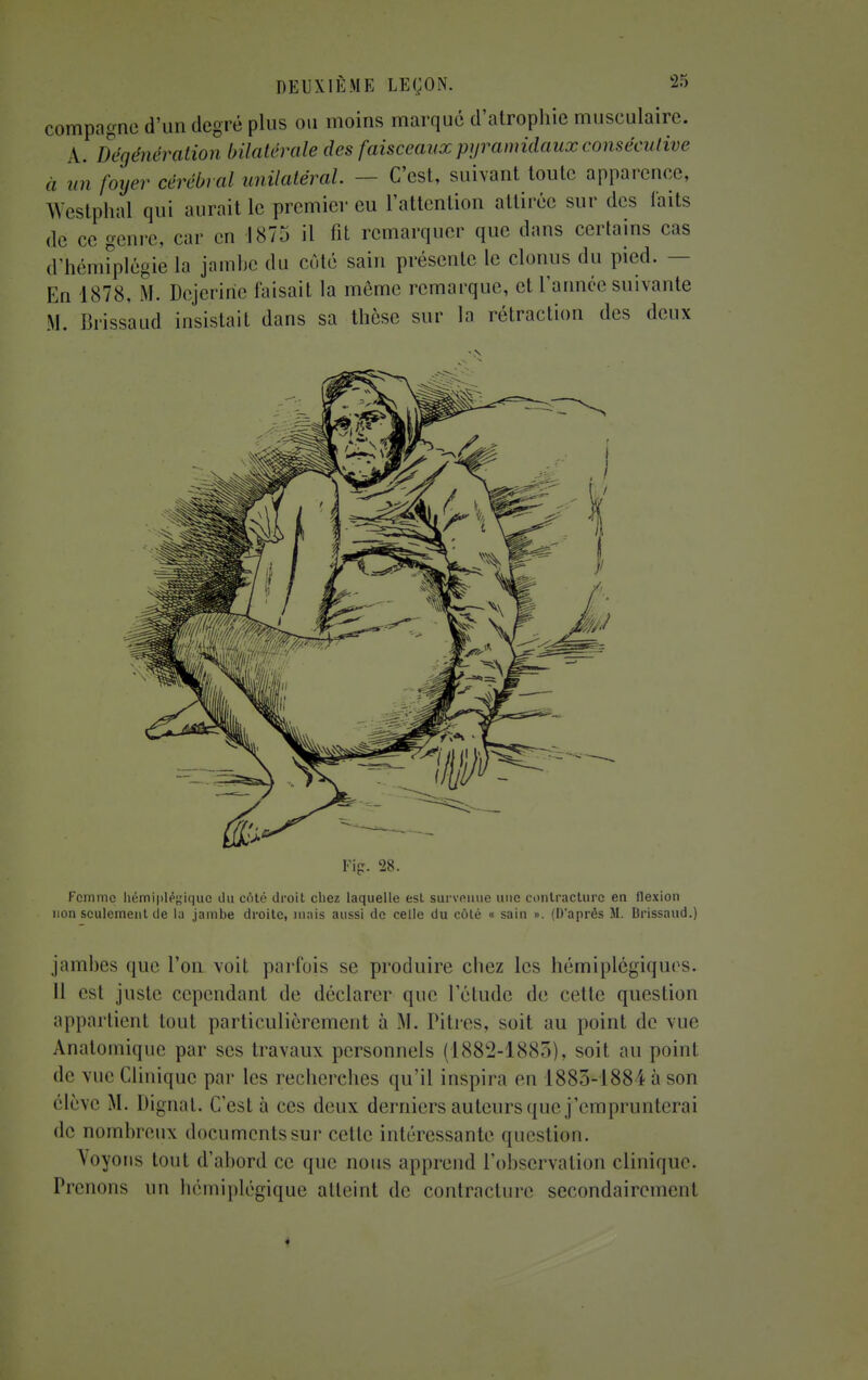 compagne d'un degré plus ou moins marqué d'atrophie musculaire. A. Dégénération bilatérale des faisceaux pyramidaux consécutive à un foyer cérébral unilatéral. — C'est, suivant toute apparence, Westphal qui aurait le premier eu l'attention attirée sur des laits de ce genre, car en 1875 il fit remarquer que dans certains cas d'hémiplégie la jambe du côté sain présente le clonus du pied. - En 1878, M. Dejerine taisait la même remarque, et l'année suivante M. Brissaud insistait dans sa thèse sur la rétraction des deux Fig. 28. Femme hémiplégique du coté droit chez laquelle est survenue une contracture en llexion non seulement de la jambe droite, mais aussi de celle du côté « sain ». (D'après SI. Brissaud.) jambes que l'on voit parfois se produire chez les hémiplégiques. 11 est juste cependant de déclarer que l'étude de cette question appartient tout particulièrement à M. Pitres, soit au point de vue Anatomique par ses travaux personnels (1882-1885), soit au point • le vue Clinique par les recherches qu'il inspira en L885-188i à son ('•lève M. Dignat. ('/est à ces deux derniers auteurs que j'emprunterai de nombreux documentssur cette intéressante question. Voyons tout d'abord ce que nous apprend l'observation clinique. Prenons un hémiplégique atteint de contracture secondairement