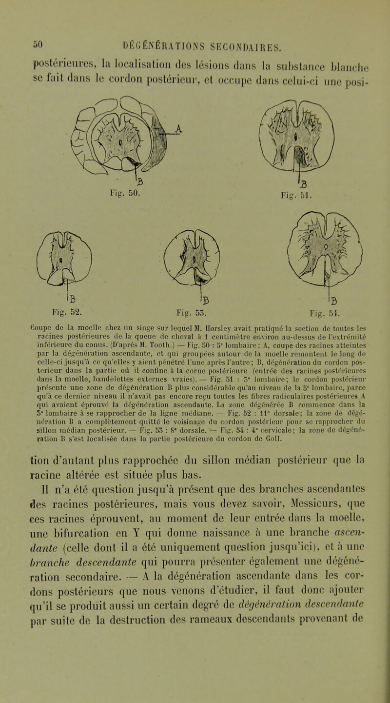 postérieures, la localisation des lésions dans la substance blanche se fait dans le cordon postérieur, et occupe dans celui-ci une posi- Fig. 52. Fig. 53. Fig. 5*. (loupe de la moelle chez un singe sur lequel M. Horsley avait pratiqué la section de toutes les racines postérieures de la queue de cheval à 1 centimètre environ au-dessus de l'extrémité inférieure du conus. (D'après M. Tooth.) — Fig. 50 : 5 lombaire; A, coupe des racines atteintes par la dégénération ascendante, et qui groupées autour de la moelle remontent le long de celle-ci jusqu'à ce qu'elles y aient pénétré l'une après l'autre; B, dégénération du cordon pos- térieur dans la partie où il confine à la corne postérieure (entrée des racines postérieures dans la moelle, bandelettes externes vraies).— Fig. 51 : 5° lombaire; le cordon postérieur présente une zone de dégénération B plus considérable qu'au niveau de la 5° lombaire, parce qu'à ce dernier niveau il n'avait pas encore reçu toutes les fibres radiculaires postérieures A qui avaient éprouvé la dégénération ascendante. La zone dégénérée B commence dans la 5° lombaire à se rapprocher de la ligne médiane. — Fig. 52 : 11 dorsale; la zone de dégé- nération B a complètement quitté le voisinage du cordon postérieur pour se rapprocher du sillon médian postérieur. — Fig. 53 : S* dorsale. — Fig. 54 : i° cervicale; la zone de dégéné- ration B s'est localisée dans la partie postérieure du cordon de Coll. tion d'autant plus rapprochée du sillon médian postérieur que la racine altérée est située plus bas. Il n'a été question jusqu'à présent que des branches ascendantes des racines postérieures, mais vous devez savoir, Messieurs, que ces racines éprouvent, au moment de leur entrée dans la moelle, une bifurcation en Y qui donne naissance à une branche ascen- dante (celle dont il a été uniquement question jusqu'ici), et à une branche descendante qui pourra présenter également une dégéné- ration secondaire. — A la dégénération ascendante dans les cor- dons postérieurs que nous venons d'étudier, il faut donc ajouter qu'il se produit aussi un certain degré de dégénèration descendante par suite de la destruction des rameaux descendants provenant de