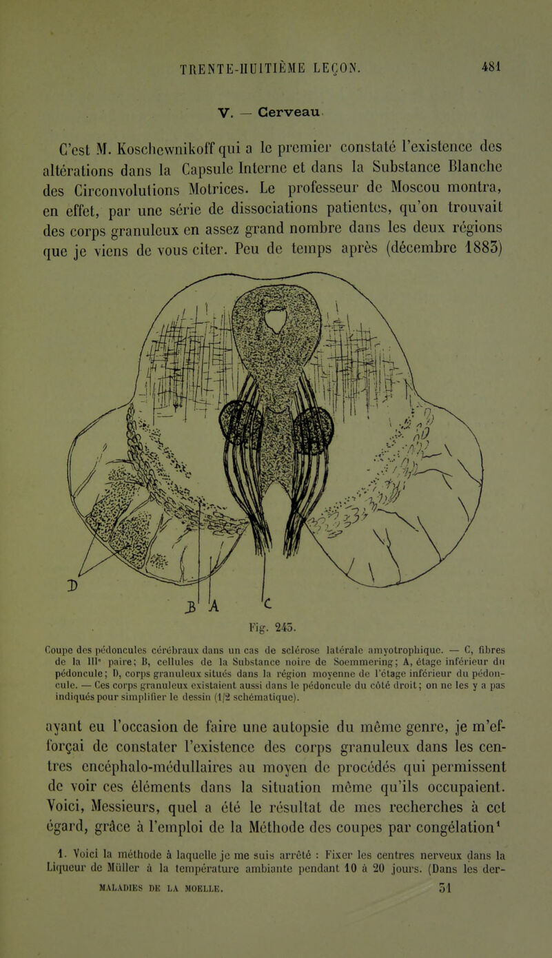 V. — Cerveau C'est M. Koschewnikoff qui a le premier constaté l'existence des altérations dans la Capsule Interne et clans la Substance Blanche des Circonvolutions Motrices. Le professeur de Moscou montra, en effet, par une série de dissociations patientes, qu'on trouvait des corps granuleux en assez grand nombre dans les deux régions que je viens de vous citer. Peu de temps après (décembre 1883) Fig. 245. Coupe des pédoncules cérébraux dans un cas de sclérose latérale amyotrophique. — C, fibres de la 111' paire; B, cellules de la Substance noire de Soemmering; A, étage inférieur du pédoncule; D, corps granuleux situés dans la région moyenne de l'étage inférieur du pédon- cule. — Ces corps granuleux existaient aussi clans le pédoncule du côté droit; on ne les y a pas indiqués pour simplifier le dessin (1/2 schématique). ayant eu l'occasion de faire une autopsie du même genre, je m'ef- forçai de constater l'existence des corps granuleux dans les cen- tres cncéphalo-médullaires au moyen de procédés qui permissent de voir ces éléments dans la situation même qu'ils occupaient. Voici, Messieurs, quel a été le résultat de mes recherches à cet égard, grâce à l'emploi de la Méthode des coupes par congélation1 1. Voici la méthode à laquelle je me suis arrêté : Fixer les centres nerveux dans la Liqueur de Miillcr à la température ambiante pendant 10 à 20 jours. (Dans les der- MALAP1ES DE LA MOELLE. 51