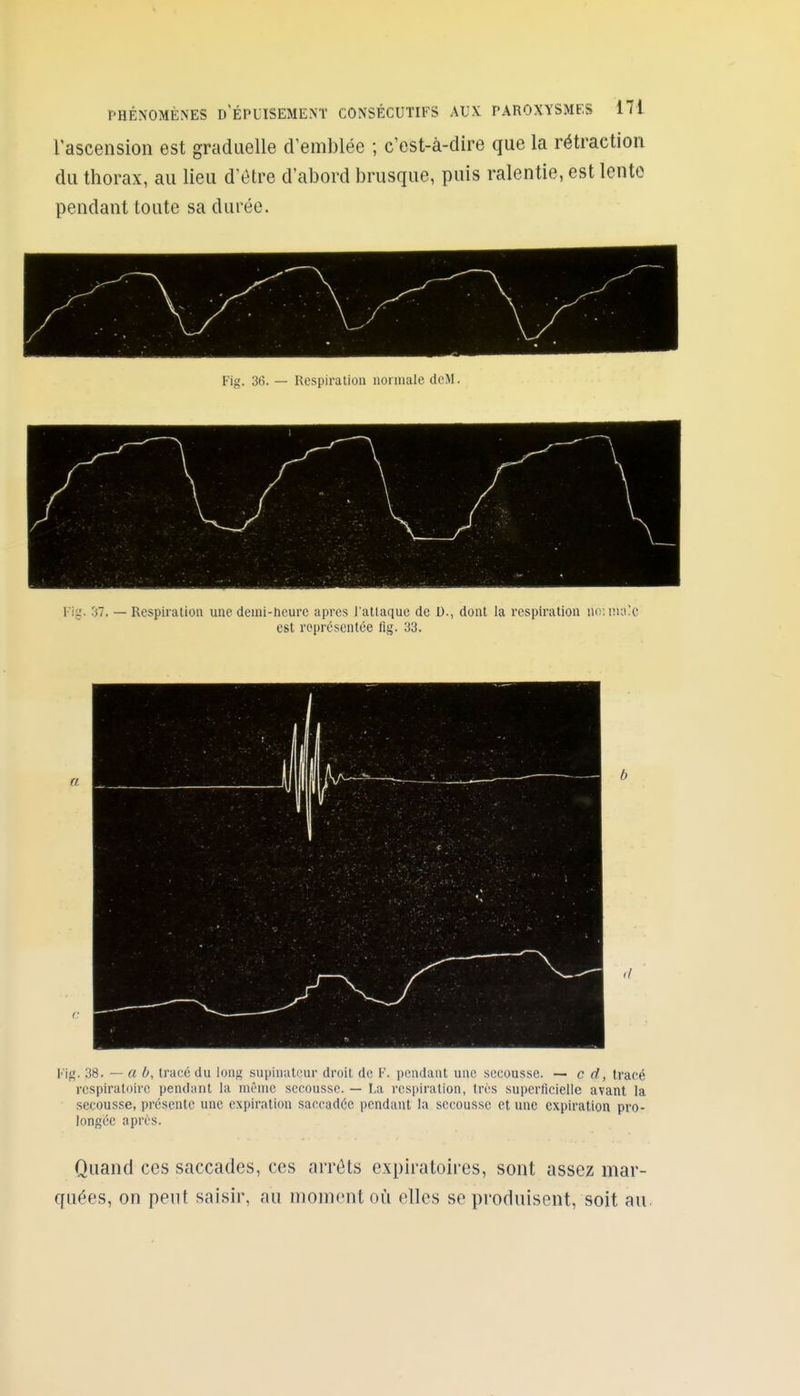 rascensioii est graduelle d'emblée ; c'est-à-dire que la rétraction du thorax, au lieu d'être d'abord brusque, puis ralentie, est lente pendant toute sa durée. Fig. 30. — Respiration normale dcM. V'i'j. 'il. — Respiration une denii-hcurc après l'attaque de U., dont la respiration U(;'. iïuuc est représentée fig. 33. Fig. 38. — a b, tracé du long supinalcur droit de F. pendant une secousse. ~ c d, tracé respiratoire pendant la même secousse. — La respiration, très superficielle avant la secousse, présente une expiration saccadée pendant la secousse et une expiration pro- longée après. Quand ces saccades, ces arrêts expiratoires, sont assez mar- quées, on peut saisir, au moment où elles se produisent, soit au.