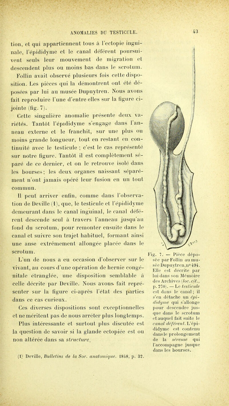 tion, et qui appartiennent tous à l'ectopie ingui- nale, lepididyme et le canal déférent poursui- vent seuls leur mouvement de migration et descendent plus ou moins bas dans le scrotum. FoUin avait observé plusieurs fois cette dispo- sition. Les pièces qui la démontrent ont été dé- posées par lui au musée Dupuytren. Nous avons fait reproduire l'une d'entre elles sur la figure ci- jointe (flg. 7). Cette singulière anomalie présente deux va- riétés. Tantôt l'épididyme s'engage dans l'an- neau externe et le franchit, sur une plus ou moins grande longueur, tout en restant en con- tinuité avec le testicule ; c'est le cas représenté sur notre figure. Tantôt il est complètement sé- paré de ce dernier, et on le retrouve isolé dans les bourses; les deux organes naissant séparé- ment n'ont jamais opéré leur fusion en un tout commun. 11 peut arriver enfin, comme dans l'observa- tion de Deville (1), que, le testicule et l'épididyme demeurant dans le canal inguinal, le canal défé- rent descende seul à travers l'anneau jusqu'au fond du scrotum, pour remonter ensuite dans le canal et suivre son trajet habituel, formant ainsi une anse extrêmement allongée placée dans le scrotum. L'un de nous a eu occasion d'observer sur le vivant, au cours d'une opération de hernie congé- nitale étranglée, une disposition semblable à celle décrite par Deville. Nous avons fait repré- senter sur la figure ci-après l'état des parties dans ce cas curieux. Ces diverses dispositions sont exceptionnelles et ne méritent pas de nous arrêter plus longtemps. Plus intéressante et surtout plus discutée est la question de savoir si la glande ectopiée est ou non altérée dans sa structure. (1) Deville, Bulletins de la Soc. anatomique. 1848, p. 32. Fig. 7. — Pièce dépo- sée parFollin au mu- sée Dupuytreu,00494. Elle est décrite par lui daos son Mémoire des Archives [loc.cit., p. 270). — Le testicule est dans le canal ; il s'en détache un épi- dichjrne qui s'allonge pour descendre jus- que dans le scrotum et auquel fait suite le canal déférent. L'épi- didyme est contenu dans le prolongement de la séreuse qui l'accompagne jusque dans les bourses.