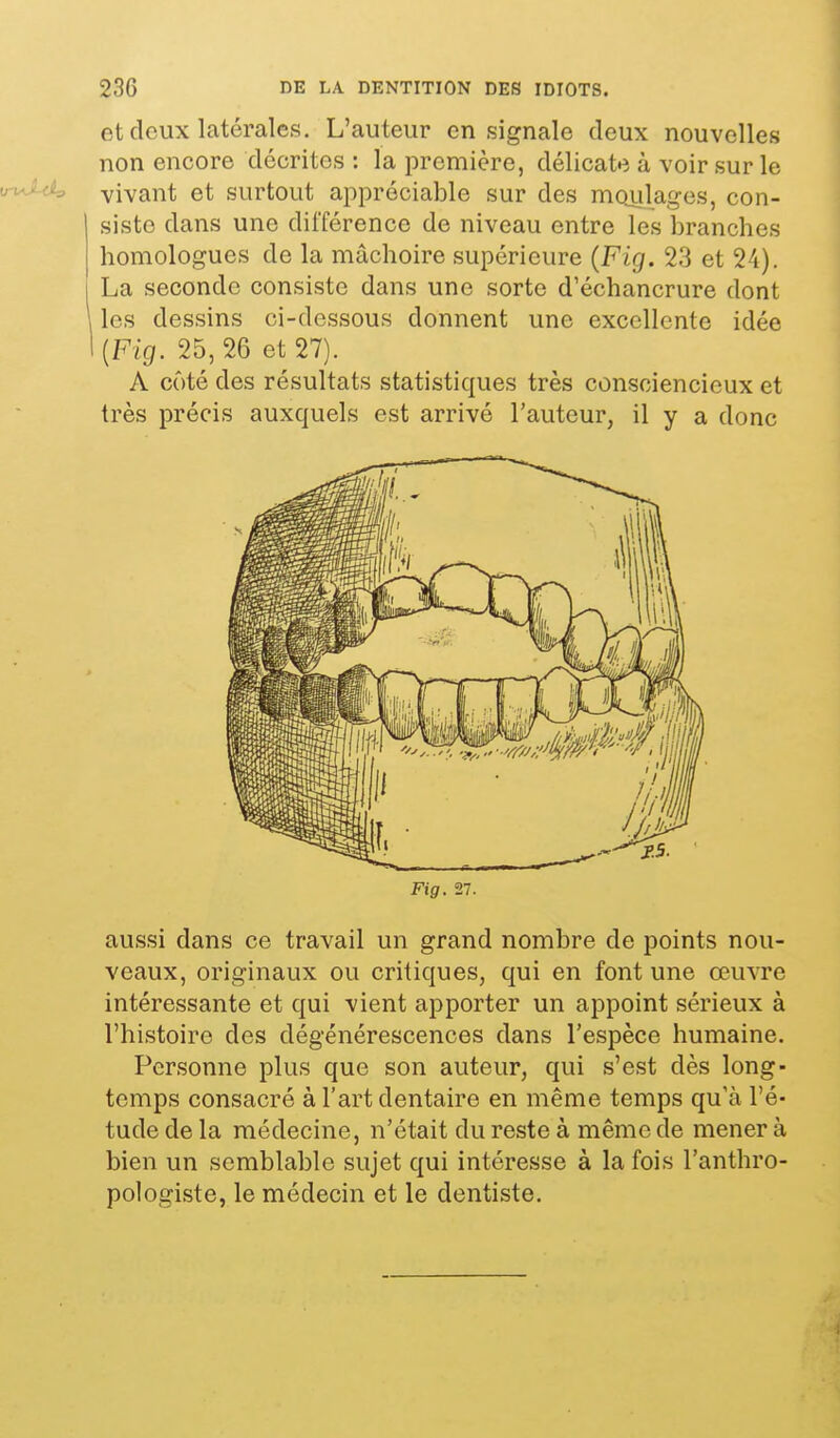 et deux latérales. L'auteur en signale deux nouvelles non encore décrites : la première, délicate à voir sur le vivant et surtout appréciable sur des moulages, con- siste dans une dilTérence de niveau entre les branches homologues de la mâchoire supérieure {Fig. 23 et 24). La seconde consiste dans une sorte d'échancrure dont les dessins ci-dessous donnent une excellente idée {Fig. 25, 26 et 27). A côté des résultats statistiques très consciencieux et très précis auxquels est arrivé l'auteur, il y a donc aussi dans ce travail un grand nombre de points nou- veaux, originaux ou critiques, qui en font une œuvre intéressante et qui vient apporter un appoint sérieux à l'histoire des dégénérescences dans l'espèce humaine. Personne plus que son auteur, qui s'est dès long- temps consacré à l'art dentaire en même temps qu'à l'é- tude de la médecine, n'était du reste à même de mener à bien un semblable sujet qui intéresse à la fois l'anthro- pologiste, le médecin et le dentiste. Fig. 27.