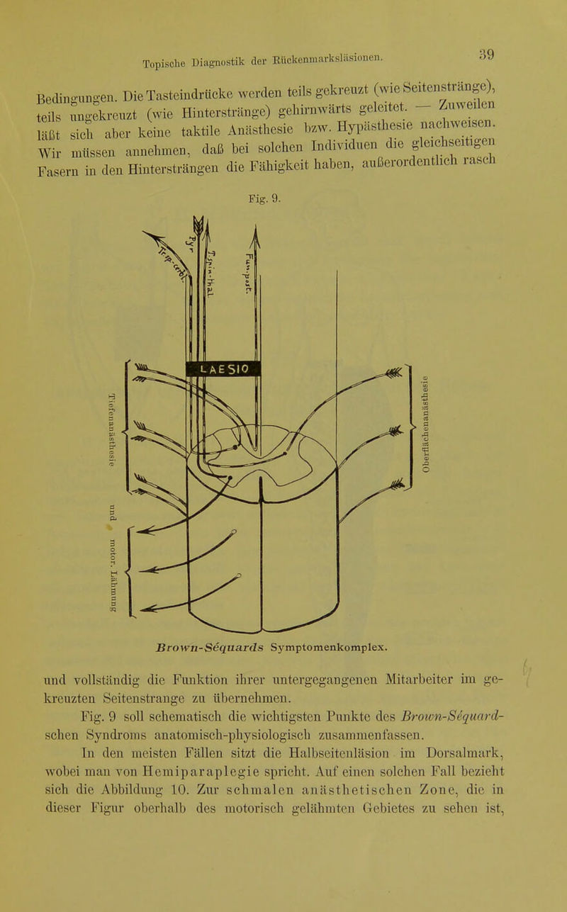 ?>9 Bedino ungen. Die Tasteindrücke werden teils gekreuzt (wie beitenstrange), fei :ngekreuzt (wie Hinterstrünge) gehirnwärts geleitet - Zuweilen Hß sich aber k ine taktile Anästhesie bzw. Hypästhesie nac^iweisen. Wir rüSLen annehmen, daß bei solchen Individuen die gleichseitigen Fasern in den Hinterstrcängen die Fähigkeit haben, außerordentlich rasch Fig. 9. Browii-Sequards Symptomenkomplex. und vollständig die Funktion ihrer untergegangenen Mitarbeiter im ge- kreuzten Seitenstrange zu übernehmen. Fig. 9 soll schematisch die wichtigsten Punkte des Brown-SSquard- schen Syndroms anatomisch-physiologisch zusammenfassen. In den meisten Fällen sitzt die Halbseitenläsion im Dorsalmark, wobei man von Hemiparaplegie spricht. Auf einen solchen Fall bezieht sich die Abbildung 10. Zur schmalen anästhetischen Zone, die in dieser Figur oberhalb des motorisch gelähmten Gebietes zu sehen ist,