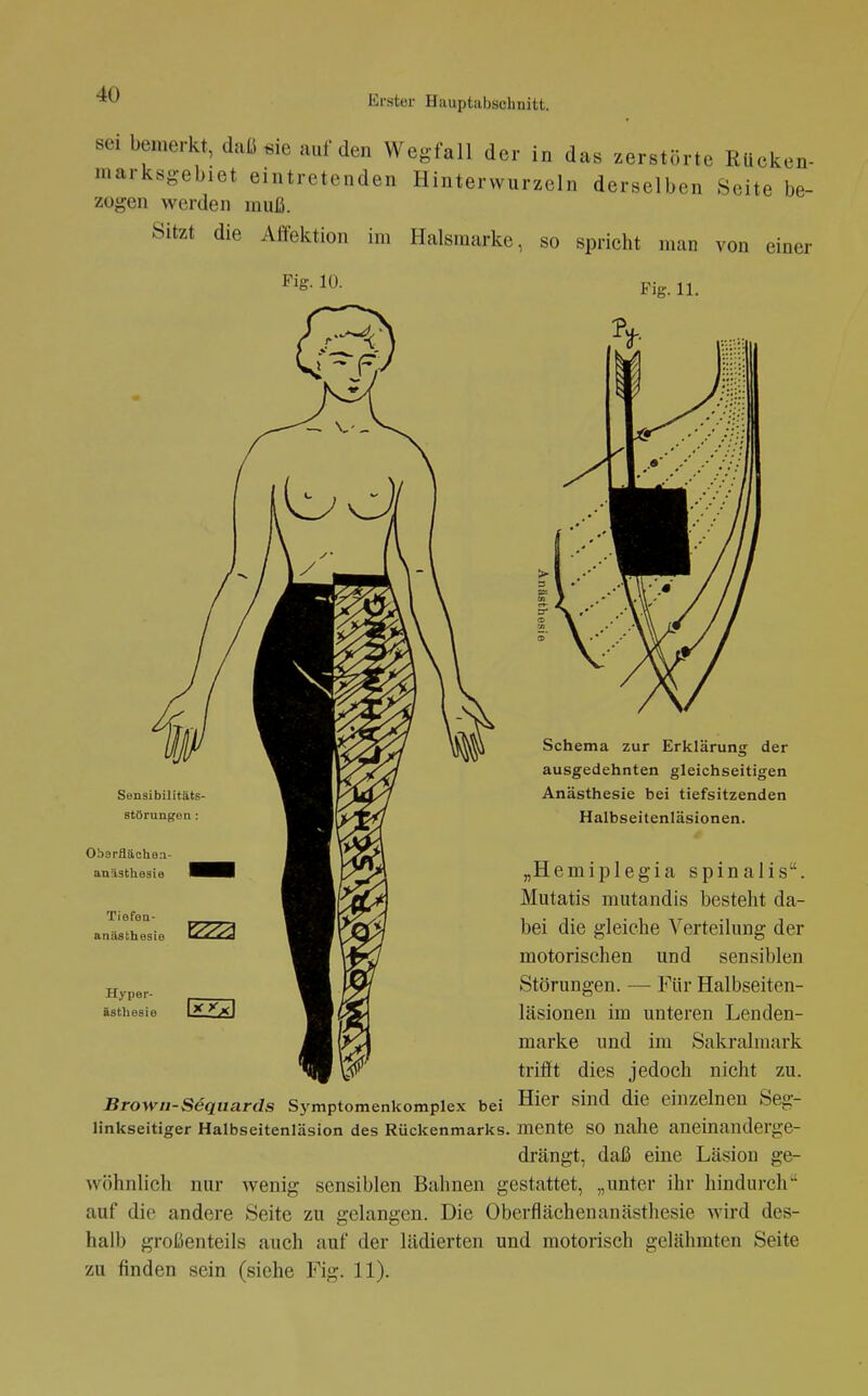 sei bemerkt, daß sie auf den Wegfall der in das zerstörte Rücken- marksgebiet eintretenden Hintervvurzeln derselben Seite be- zogen werden muß. Sitzt die Affektion im Halsraarke, so spricht man von einer Fig. 10. Hyper- tsthesie Fig. 11. Schema zur Erklärung der ausgedehnten gleichseitigen Anästhesie bei tiefsitzenden Halbseitenläsionen. „Hemiplegia spinalis. Mutatis mutandis besteht da- bei die gleiche A^erteilung der motorischen und sensiblen Störungen. — Für Halbseiten- läsionen im unteren Lenden- marke und im Sakralmark trifft dies jedoch nicht zu. Brown-Sequards Symptomenkomplex bei Hier sind die einzelnen Seg- linkseitiger Halbseitenläsion des Rückenmarks, mente SO nalie aneinanderge- drängt, daß eine Läsiou ge- wöhnlich nur wenig sensiblen Bahnen gestattet, „unter ihr hindurch auf die andere Seite zu gelangen. Die Oberflächenanästhesie wird des- halb großenteils auch auf der lädierten und motorisch gelähmten Seite zu finden sein (siehe Fig. 11).