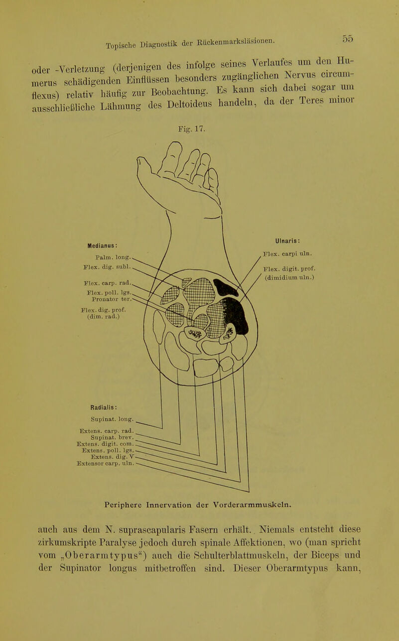 oder -Verletzung (derjenigen des infolge seines Verlaufes um den Hu- r^L ^ZäioJnäL Ein/üssen besonders zugänglichen Nervus cu-cum- flexus) lelativ häufig zur Beobachtung. Es kann sich dabei sogar um a^^äli^ßliehe Lähm^mg des Deltoideus handeln, da der Teres mmor Fig. 17. Medianus: Palm. long. Plex. dig. subl. Flox. carp. rad. Flex. poll. Igs. Pronator ter. Flex. dig. prof. (dim. rad.) Radialis: Supinat. long. Extens. cari). rad. Supinat. brev. Extens. digit. com. Extens. poll. Igs. Extens. dig. V Extensor cai-p. nln. Ulnaris: Flex. carpi uln. Flex. digit. prof. (dimidinm uln.) Periphere Innervation der Vorderarmmuskeln. auch aus dem N. suprascapularis Fasern erhält. Niemals entsteht diese zirkumskripte Pai'alyse jedoch durch spinale Affektionen, wo (man spricht vom „Oberarmtypus) auch die Schulterblattmuskeln, der Biceps und der tSupinator longus mitbetroffen sind. Dieser Oberarmtypus kann,
