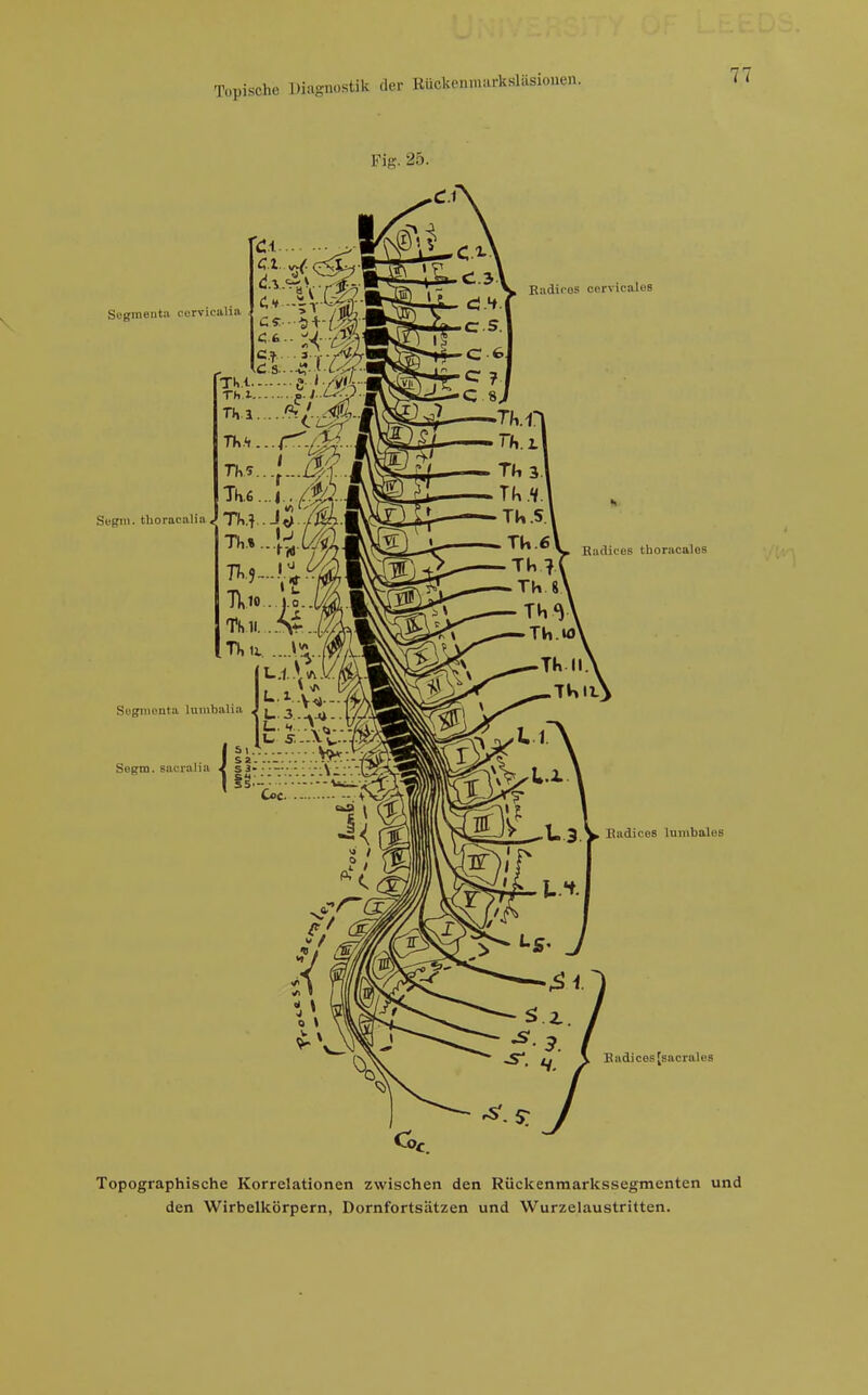 Fig. 25. Badic'OS cßrvicales Segmenta cerviealia Segm. thoracalia Sognienta luinbalia Segm. saeralia Kadices thoracales Eadices lumbales Badicesjsacrales Topographische Korrelationen zwischen den Rückenraarkssegmenten und den Wirbelkörpern, Dornfortsätzen und Wurzelaustritten.