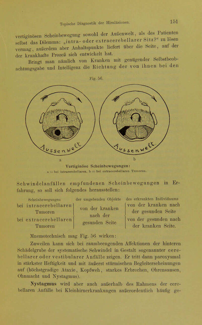 vertiginösen öcheinbewegung sowohl der Außenwelt, als des Patienten selbst das Dilemma: „intra-oder extracerebellarer Sitz? zu losen vermag, außerdem aber Anhaltspunkte liefert über die Seite, auf der der krankhafte Prozeß sich entwickelt hat. Bringt man nämlich von Kranken mit genügender Selbstbeob- achtungsgabe und Intelligenz die Richtung der von ihnen bei den Fig. 56. a b Vertiginöse Scheinbewegungen: a = bei intracerebellaren, b = bei extraoerebellaren Tumoren. Schwindelanfällen empfundenen Scheinbewegungen in Er- fahrung, so soll sich folgendes herausstellen: Scheinbewegungen der umgebenden Objekte des erkrankten Individuums bei intracerebellaren Tumoren bei extracerebellaren Tumoren von der kranken nach der gesunden Seite von der kranken nach der gesunden Seite von der gesunden nach der kranken Seite. Mnemotechnisch mag Fig. 56 wirken: Zuweilen kann sich bei raumbeengenden Affektionen der hinteren Schädelgrube der systematische Schwindel in Gestalt sogenannter cere- bellarer oder vestibulärer Anfälle zeigen. Er tritt dann paroxysmal in stärkster Heftigkeit und mit äußerst stürmischen Begleiterscheinungen auf (höchstgradige Ataxie, Kopfweh, starkes Erbrechen, Ohrensausen, Ohnmacht und Nystagmus). Nystagmus wird aber auch außerhalb des Rahmens der cere- bellaren Anfälle bei Kleinhimerkrankungen außerordentlich häufig ge-