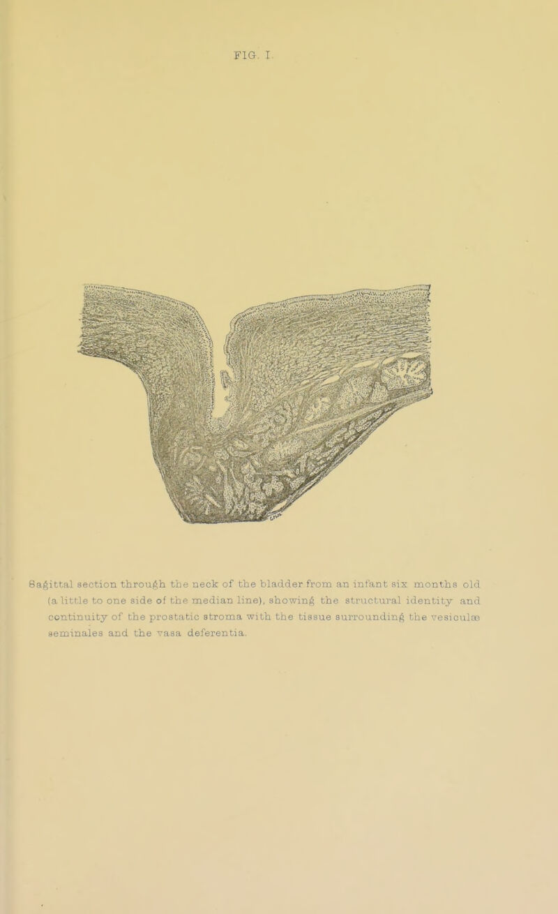 FIG. I. Sagittal section throuAh tbe neck of the bladder from an infant six months old (a little to one side of thp median line), showinfS the structural identity and continuity of the prostatic stroma with the tissue surroundmf^ the vesiculas seminalea and the vasa deferentia.