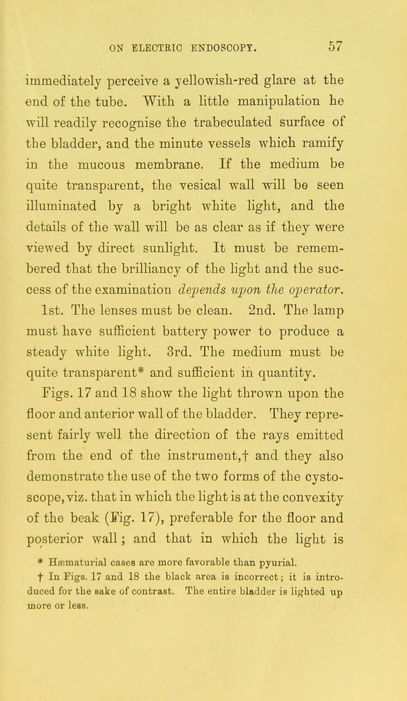 immediately perceive a yellowish-red glare at the end of the tube. With a little manipulation he will readily recognise the trabeculated surface of the bladder, and the minute vessels which ramify in the mucous membrane. If the medium be quite transparent, the vesical wall will be seen illuminated by a bright white light, and the details of the wall will be as clear as if they were viewed by direct sunlight. It must be remem- bered that the brilliancy of the light and the suc- cess of the examination depends upon the operator. 1st. The lenses must be clean. 2nd. The lamp must have suflQcient battery power to produce a steady white light. 3rd. The medium must be quite transparent* and suflQcient in quantity. Figs. 17 and 18 show the light thrown upon the floor and anterior wall of the bladder. They repre- sent fairly well the direction of the rays emitted from the end of the insfcrument,t and they also demonstrate the use of the two forms of the cysto- scope, viz. that in which the light is at the convexity of the beak (Fig. 17), preferable for the floor and posterior wall; and that in which the light is * Hffimaturial cases are more favorable than pyurial. t In Figs. 17 and 18 the black area is incorrect; it is intro- duced for the sake of contrast. The entire bladder is lighted up more or less.