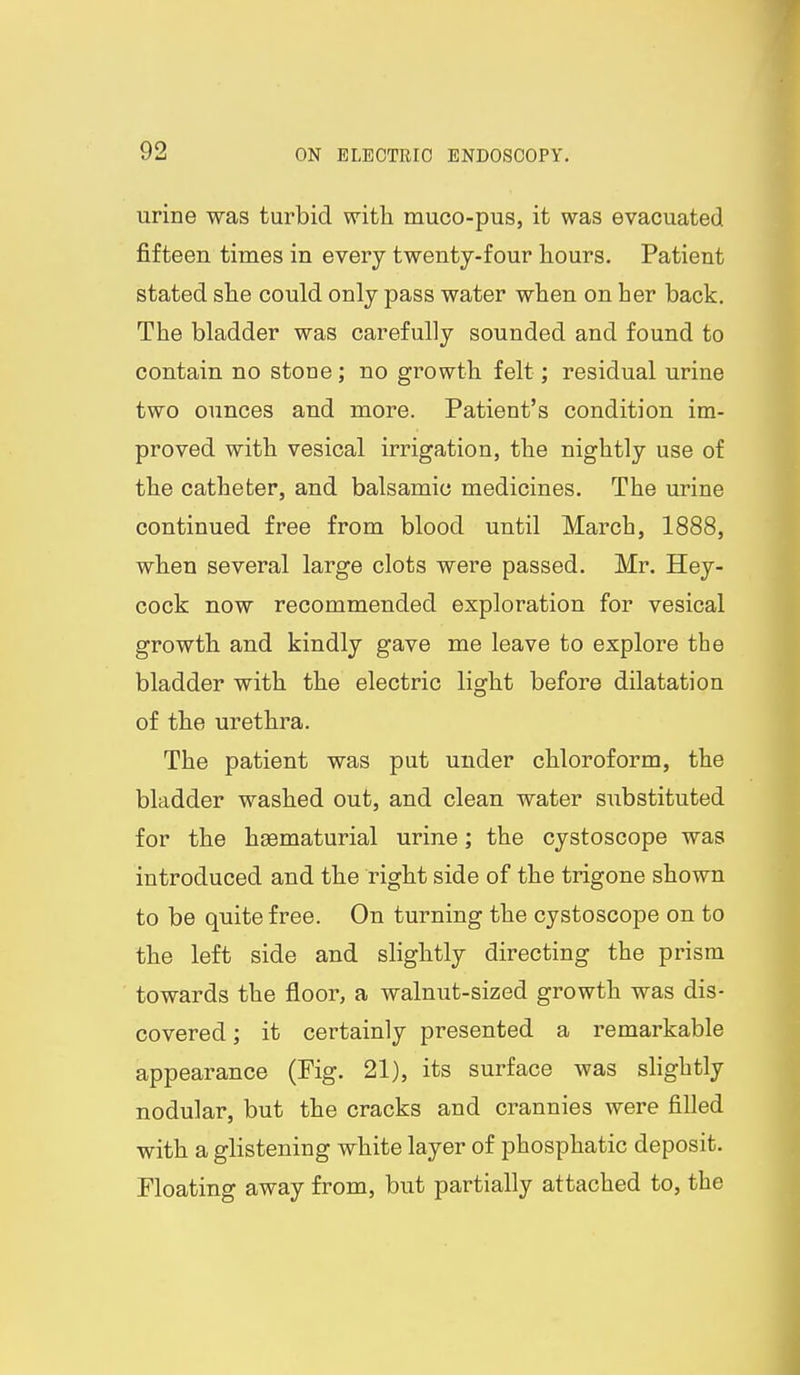urine was turbid with muco-pus, it was evacuated fifteen times in every twenty-four hours. Patient stated she could only pass water when on her back. The bladder was carefully sounded and found to contain no stone; no growth felt; residual urine two ounces and more. Patient's condition im- proved with vesical irrigation, the nightly use of the catheter, and balsamic medicines. The urine continued free from blood until March, 1888, when several large clots were passed. Mr. Hey- cock now recommended exploration for vesical growth and kindly gave me leave to explore the bladder with the electric light before dilatation of the urethra. The patient was put under chloroform, the bladder washed out, and clean water substituted for the heematurial urine; the cystoscope was introduced and the right side of the trigone shown to be quite free. On turning the cystoscope on to the left side and slightly directing the prism towards the floor, a walnut-sized growth was dis- covered ; it certainly presented a remarkable appearance (Fig. 21), its surface was slightly nodular, but the cracks and crannies were filled with a glistening white layer of phosphatic deposit. Floating away from, but partially attached to, the