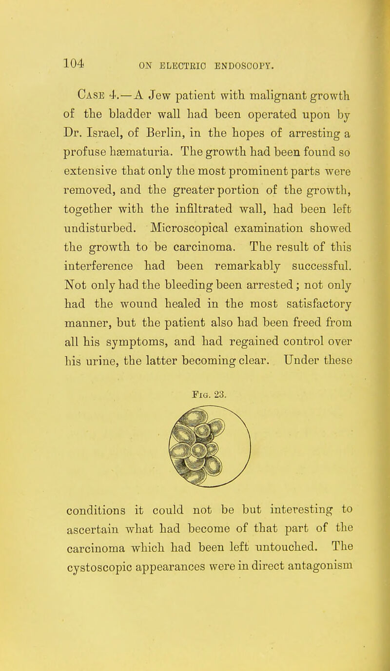 Case 4.—A Jew patient with malignant growth of the bladder wall had been operated upon by Dr. Israel, of Berlin, in the hopes of arresting a profuse hgematuria. The growth had been found so extensive that only the most prominent parts were removed, and the greater portion of the growth, together with the infiltrated wall, had been left undisturbed. Microscopical examination showed the growth to be carcinoma. The result of this interference had been remarkably successful. Not only had the bleeding been arrested; not only had the wound healed in the most satisfactory manner, but the patient also had been freed from all his symptoms, and had regained control over his urine, the latter becoming clear. Under these Fig. 23. conditions it could not be but interesting to ascertain what had become of that part of the carcinoma which had been left untouched. The cystoscopic appearances were in direct antagonism