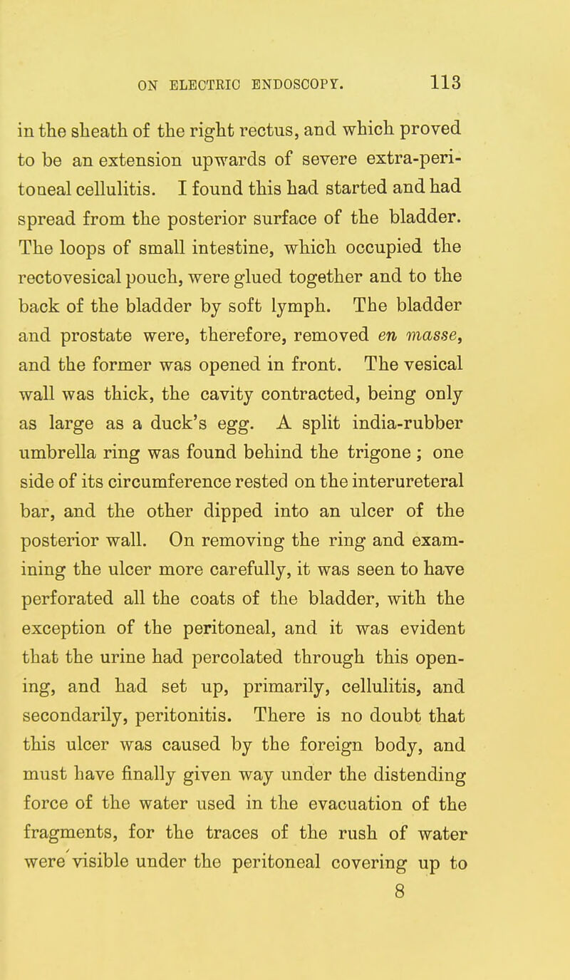 in the sheath of the right rectus, and which proved to be an extension upwards of severe extra-peri- toneal cellulitis. I found this had started and had spread from the posterior surface of the bladder. The loops of small intestine, which occupied the rectovesical pouch, were glued together and to the back of the bladder by soft lymph. The bladder and prostate were, therefore, removed en masse, and the former was opened in front. The vesical wall was thick, the cavity contracted, being only as large as a duck's egg. A split india-rubber umbrella ring was found behind the trigone ; one side of its circumference rested on the interureteral bar, and the other dipped into an ulcer of the posterior wall. On removing the ring and exam- ining the ulcer more carefully, it was seen to have perforated all the coats of the bladder, with the exception of the peritoneal, and it was evident that the urine had percolated through this open- ing, and had set up, primarily, cellulitis, and secondarily, peritonitis. There is no doubt that this ulcer was caused by the foreign body, and must have finally given way under the distending force of the water used in the evacuation of the fragments, for the traces of the rush of water were visible under the peritoneal covering up to 8
