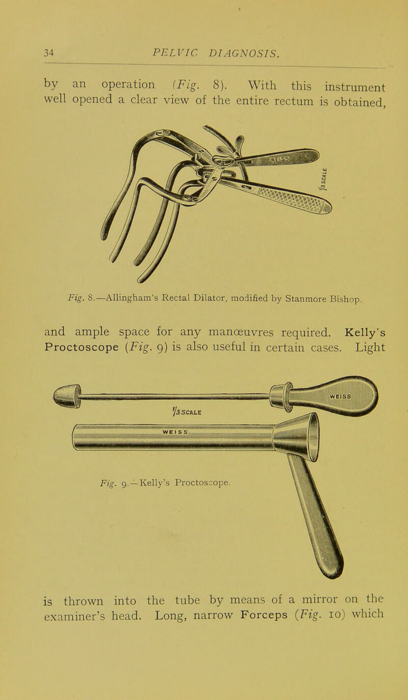 by an operation (Fig. 8). With this instrument well opened a clear view of the entire rectum is obtained, Fig. 8.—AUingham's Rectal Dilator, modified by Stanmore Bishop. and ample space for any manoeuvres required. Kelly's Proctoscope {Fig. 9) is also useful in certain cases. Light is thrown into the tube by means of a mirror on the examiner's head. Long, narrow Forceps (Fig. 10) which