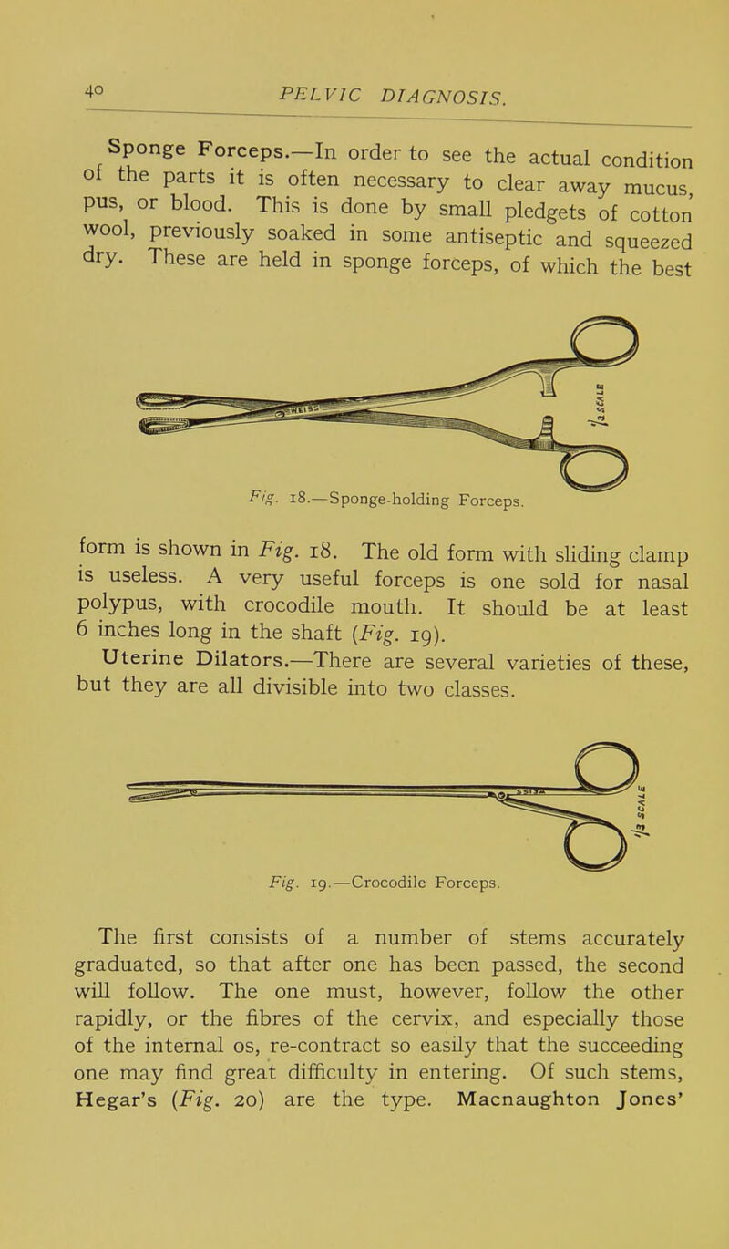 Sponge Forceps.-In order to see the actual condition ot the parts it is often necessary to clear away mucus pus, or blood. This is done by small pledgets of cotton wool, previously soaked in some antiseptic and squeezed dry. These are held in sponge forceps, of which the best form is shown in Fig. i8. The old form with sliding clamp is useless. A very useful forceps is one sold for nasal polypus, with crocodile mouth. It should be at least 6 inches long in the shaft {Fig. 19). Uterine Dilators.—There are several varieties of these, but they are all divisible into two classes. Fig. 19.—Crocodile Forceps. The first consists of a number of stems accurately graduated, so that after one has been passed, the second will follow. The one must, however, follow the other rapidly, or the fibres of the cervix, and especially those of the internal os, re-contract so easily that the succeeding one may find great difficulty in entering. Of such stems, Hegar's (Fig. 20) are the type. Macnaughton Jones'