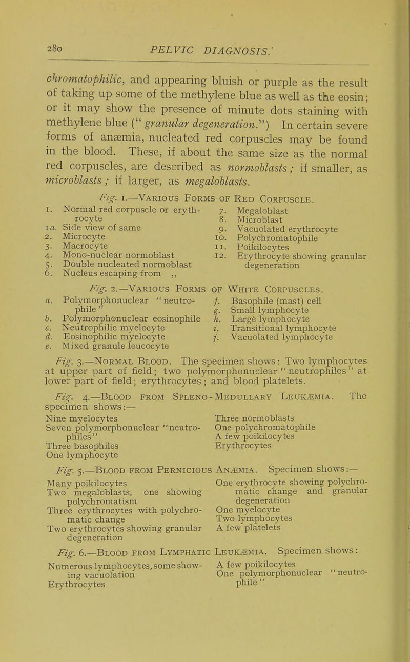 chromatophilic, and appearing bluish or purple as the result of taking up some of the methylene blue as well as the eosin; or it may show the presence of minute dots staining with methylene blue ( granular degenerationr) In certain severe forms of anaemia, nucleated red corpuscles may be found in the blood. These, if about the same size as the normal red corpuscles, are described as normoblasts; if smaller, as microblasts ; if larger, as megalohlasts. Microblast Vacuolated erythrocyte Polychromatophile Poikilocytes Erythrocyte showing granular I^ig- I.—Various Forms of Red Corpuscle. 1. Normal red corpuscle or eryth- 7. Megaloblast rocyte 8 I a. Side view of same 9 2. Microcyte 10 3. Macrocyte 11 4. Mono-nuclear normoblast 12 5. Double nucleated normoblast degeneration 6. Nucleus escaping from ,, Fig. 1.—Various Forms of White Corpuscles. a. Polymorphonuclear neutro- /. Basophile (mast) cell phile g. Small lymphocyte h. Polymorphonuclear eosinophile h. Large lymphocyte c. Neutrophilic myelocyte i. Transitional lymphocyte d. Eosinophilic myelocyte /. Vacuolated lymphocyte e. Mixed granule leucocyte Fig. 3.—Normal Blood. The specimen shows: Two lymphocytes at upper part of field; two polymorphonuclear  neutrophiles  at lower part of field; erythrocytes; and blood platelets. Fig. 4.—Blood from Spleno-Medullary Leuic^mia. The specimen shows:— Nine myelocytes Three normoblasts Seven polymorphonuclear neutro- One polychromatophile philes A few poikilocytes Three basophiles Erythrocytes One lymphocyte Fig. 5.—Blood from Pernicious Anemia. Specimen shows:— Many poikilocytes One erythrocyte showing polychro- Two megaloblasts, one showing matic change and granular polychromatism degeneration Three erythrocytes with polychro- One myelocyte matic change Two lymphocytes Two erythrocytes showing granular A few platelets degeneration Fig_ 6.—Blood from Lymphatic Leuk.^;mia. Specimen shows: Numerous lymphocytes, some show- A few poikilocytes ing vacuolation One polymorphonuclear neutro- Erythrocytes pliile