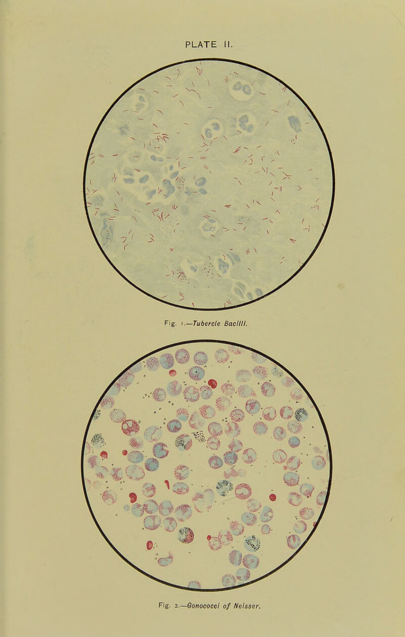 PLATE II. Fig. 2.—Oonococci of Neisser.