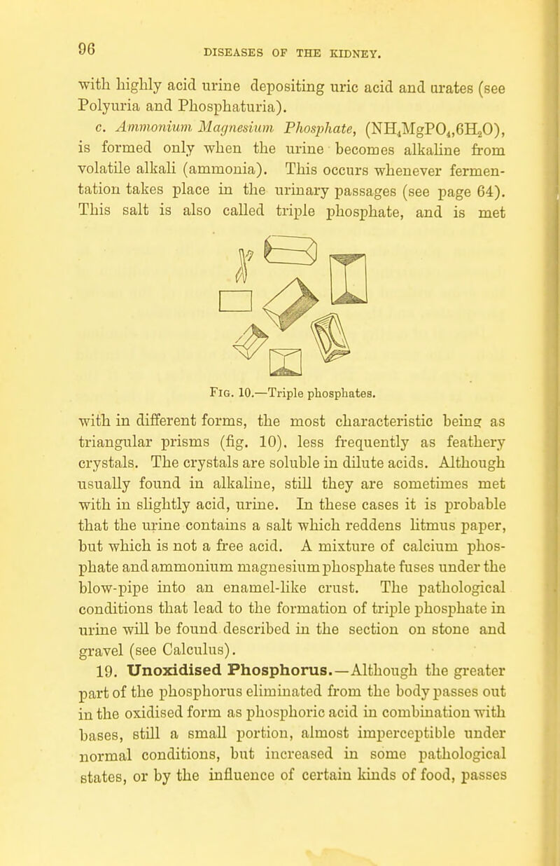 with highly acid urine depositing uric acid and urates (see Polyuria and Phosphaturia). c. Ammonium Magnesium Phosphate, (NHiMgPO^.GHaO), is formed only when the urine becomes alkahne from volatile alkali (ammonia). This occurs whenever fermen- tation takes place in the urinary passages (see page 64). This salt is also called triple phosphate, and is met Fig. 10.—Triple phosphates. with in different forms, the most characteristic being as triangular prisms (fig. 10). less frequently as feathery crystals. The crystals are soluble in dilute acids. Although usually found in alkaline, still they are sometimes met with in slightly acid, urine. In these cases it is probable that the urine contains a salt which reddens litmus paper, but which is not a free acid. A mixture of calcium phos- phate and ammonium magnesium phosphate fuses under the blow-pipe into an enamel-like crust. The pathological conditions that lead to the formation of triple phosphate in urine will be found described in the section on stone and gravel (see Calculus). 19. Unoxidised Phosphorus.—Although the greater part of the phosphorus eliminated from the bodyj)asses out in the oxidised form as phosphoric acid in combination with bases, still a small portion, almost imperceptible under normal conditions, but increased in some pathological states, or by the influence of certain kinds of food, passes