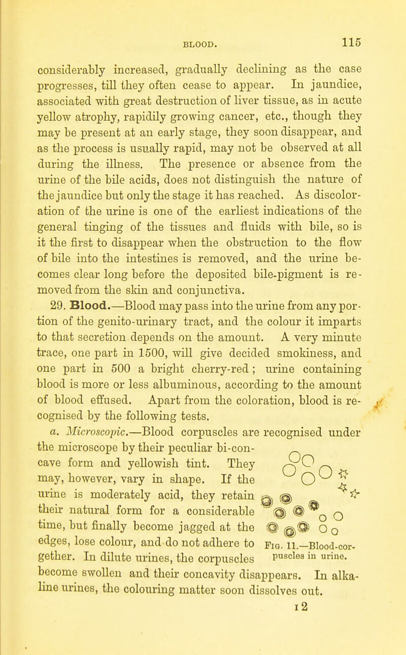 considerably increased, gradually declining as the case progresses, till they often cease to appear. In jaundice, associated with great destruction of liver tissue, as in acute yellow atrophy, rapidily growing cancer, etc., though they may be present at an early stage, they soon disappear, and as the process is usually rapid, may not be observed at all during the illness. The presence or absence from the urine of the bile acids, does not distinguish the nature of the jaundice but only the stage it has reached. As discolor- ation of the urine is one of the earliest indications of the general tinging of the tissues and fluids with bile, so is it the first to disappear when the obstruction to the flow of bile into the intestines is removed, and the urine be- comes clear long before the deposited bile-pigment is re- moved from the skin and conjunctiva. 29. Blood.—Blood may pass into the urine from any por- tion of the genito-urinary tract, and the colour it imparts to that secretion depends on the amount. A very minute trace, one part in 1500, will give decided smokiness, and one part in 500 a bright cherry-red; urine containing blood is more or less albuminous, according to the amount of blood effused. Apart from the coloration, blood is re- cognised by the following tests. a. Microscopic.—Blood corpuscles are recognised under the microscope by their peculiar bi-con- cave form and yellowish tint. They o ^ r\ may, however, vary in shape. If the O ^ urine is moderately acid, they retain q, @ their natural form for a considerable @) @ q time, but finally become jagged at the @ ^@ o o edges, lose colour, and do not adhere to Fig. 11.—Blood-cor- gether. In dilute urines, the corpuscles puscles iu uriue. become swollen and then: concavity disappears. In alka- line urines, the colouring matter soon dissolves out. i2
