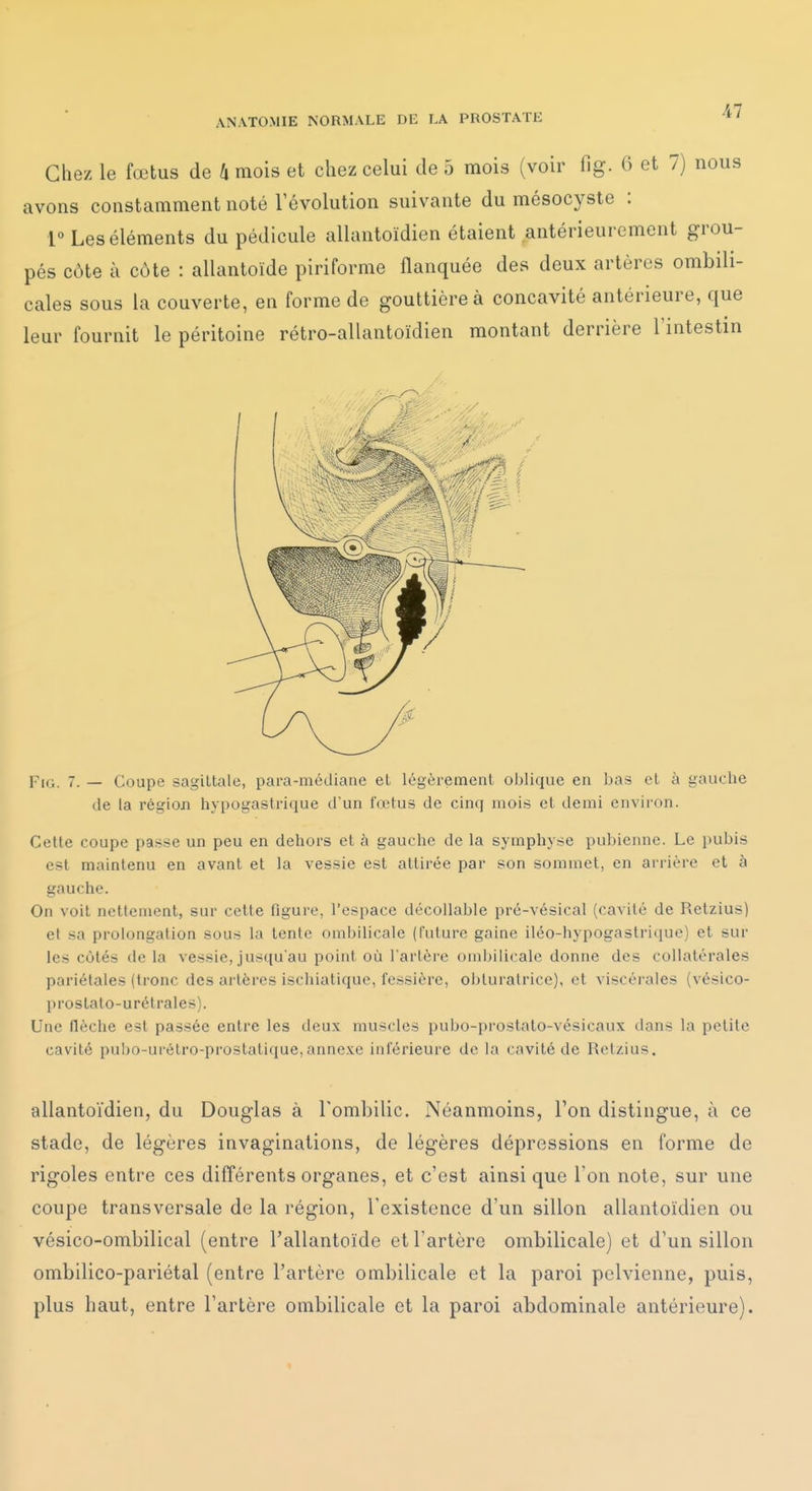 Chez le fœtus de 4 mois et chez celui de 5 mois (voir fig. 0 et 7) nous avons constamment noté l'évolution suivante du mésocyste : Les éléments du pédicule allantoïdien étaient antérieurement grou- pés côte à côte : allantoïde piriforme flanquée des deux artères ombili- cales sous la couverte, en forme de gouttière à concavité antérieure, que leur fournit le péritoine rétro-allantoïdien montant derrière l'intestin Fig. 7. — Coupe sagittale, para-médiane et légèrement oblique en bas et à gauche de la régioji hypogastrique d'un fœtus de cinq mois et demi environ. Cette coupe passe un peu en dehors et à gauche de la symphyse pubienne. Le pubis est maintenu en avant et la vessie est attirée par son sommet, en arrière et à gauche. On voit nettement, sur cette figure, l'espace décollable pré-vésical (cavité de Retzius) et sa prolongation sous la tente ombilicale (future gaine iléo-hypogastrique) et sur les côtés de la vessie, jusqu'au point où l'artère ombilicale donne des collatérales pariétales (tronc des artères ischiatique, fessière, obturatrice), et viscérales (vésico- prostalo-urétrales). Une flèche est passée entre les deux muscles pubo-prostato-vésicaux dans la petite cavité pubo-urétro-prostatique,annexe inférieure de la cavité de Retzius. allantoïdien, du Douglas à Tombilic. Néanmoins, l'on distingue, à ce stade, de légères invaginations, de légères dépressions en forme de rigoles entre ces différents organes, et c'est ainsi que Ton note, sur une coupe transversale de la région, l'existence d'un sillon allantoïdien ou vésico-ombilical (entre l'allantoïde et l'artère ombilicale) et d'un sillon ombilico-pariétal (entre l'artère ombilicale et la paroi pelvienne, puis, plus haut, entre l'artère ombilicale et la paroi abdominale antérieure).