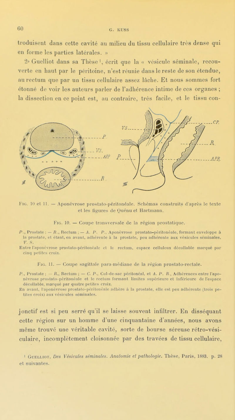 troduisent dans cette cavité au milieu du tissu cellulaire très dense qui en fo rme les parties latérales. » 20 Guelliot dans sa Thèse', écrit que la « vésicule séminale, recou- verte en haut par le péritoine, n'est réunie dans le reste de son étendue, au rectum que par un tissu cellulaire assez lâche. Et nous sommes fort étonné do voir les auteurs parler de l'adhérence intime de ces organes ; la dissection en ce point est, au contraire, très facile, et le tissu con- l'ic. 10 el 11. — Aponévrose proslalo-péritonénlo. Schémas construits d'après le texte et les figures de Ouénu et Hartmann. FiG. 10. — Coupe transversale de la région prostatique. P., Prostate : — H., Rectum ; — A. P. P., A|)onévrose proslalo-péritonéale, formant enveloppe à la prostate, et étant, en avani, .■ulhrrenle à la iiroslalc, peu adhérente aux vésicules séminales, V. S. Enlfe l'aponévrose proslalo-péritoiiéale cl le rectum, espace celluleux décollable marqué par cinq i)i;'tites croi.x. Fi(.. 11. — Coupe sagittale para-médiane de la région prostato-rectale. P., Prostate; — /?., Rectum ; — C. P., Ciit-de-sac périlonéal, el A. /\ R., Adhérences entre l'apo- névrose proslato-périlonéale et le rectum formant limites supéi'ieure el inférieure de l'espace décollable, marqué par quatre petites croix. En avant, l'aponévrose prostalo-péiilonéale adhère à la prostate, elle est peu adhérente (trois pe- tites croix) aux vésicules séminales. jonctif est si peu serré qu'il se laisse souvent infiltrer. En disséquant cette région sur un homme d'une cinquantaine d'années, nous avons même trouve une véritable cavité, sorte de bourse séreuse rétro-vési- culaire, incomplètement cloisonnée par des travées de tissu cellulaire, ' GuFXLiOT, Des Vésicules séminales. Analomie et pathologie. Thèse, Paris, 1883. p. 28 et suivantes.