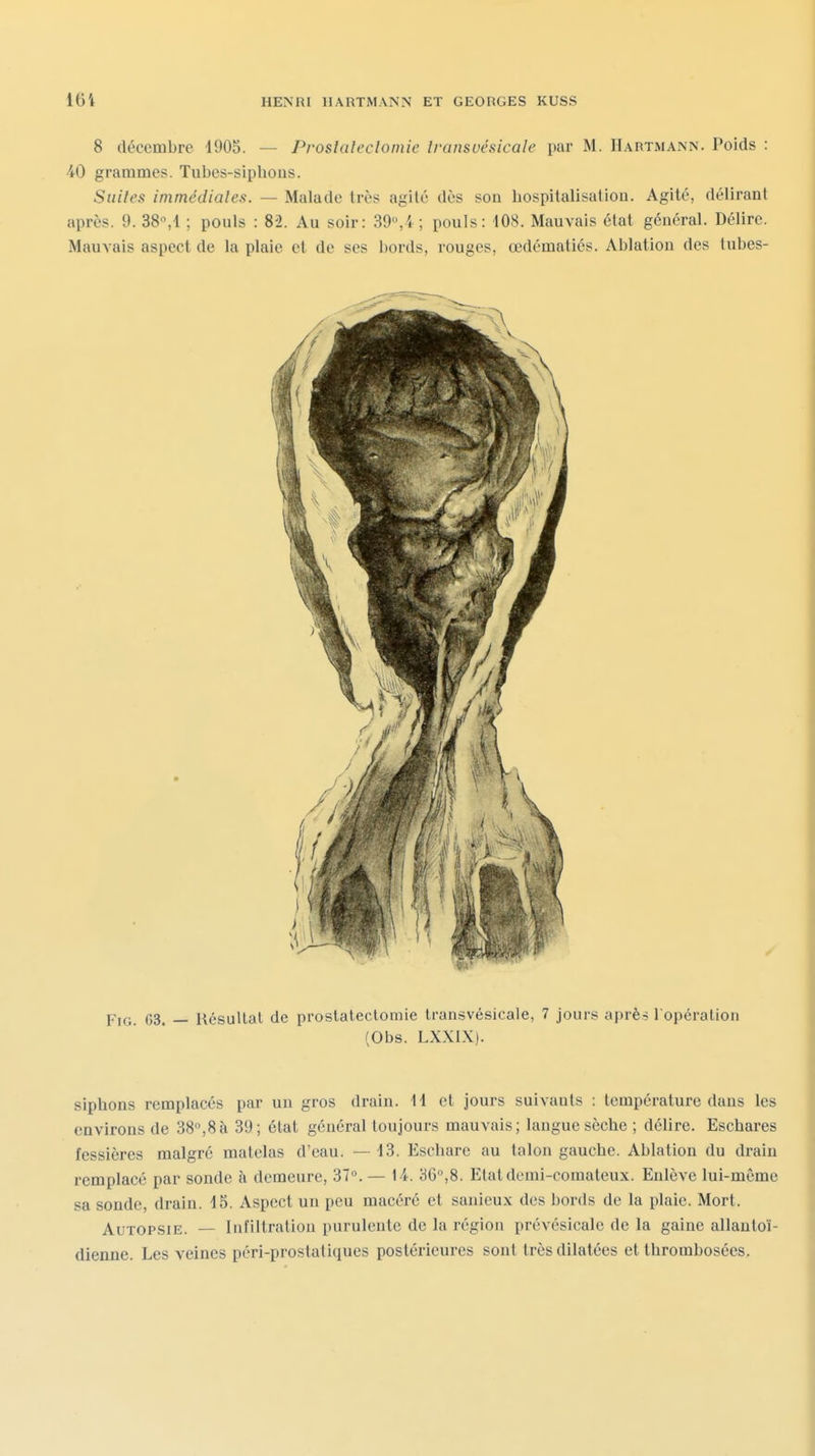 8 décembre 1905. — Proslafeclomie Iransvésicale par M. Hartmann. Poids : 'iO grammes. Tubes-siphons. Suites immédialen. — Malade très agité dès son hospitalisation. Agité, délirant après. 9. 38'\i ; pouls : 82. Au soir: 39,4; pouls: 108. Mauvais état général. Délire. Mauvais aspect de la plaie et de ses bords, rouges, œdématiés. Ablation des lubes- FiG. G3. — Résultat de prostatectomie transvésicale, 7 jours après l'opération (Obs. LXXIX). siphons remplacés par un gros drain. 11 et jours suivants : température dans les environs de 38,8à 39; état général toujours mauvais; langue sèche ; délire. Eschares fessières malgré matelas d'eau. —13. Eschare au talon gauche. Ablation du drain remplacé par sonde à demeure, 37». — 14. 36,8. Etat demi-comateux. Enlève lui-même sa sonde, drain. 15. Aspect un peu macéré et sanieux des bords de la plaie. Mort. Autopsie. — Infiltration purulente de la région prévésicale de la gaine allantoï- dienne. Les veines péri-prostatiques postérieures sont très dilatées et thrombosées.