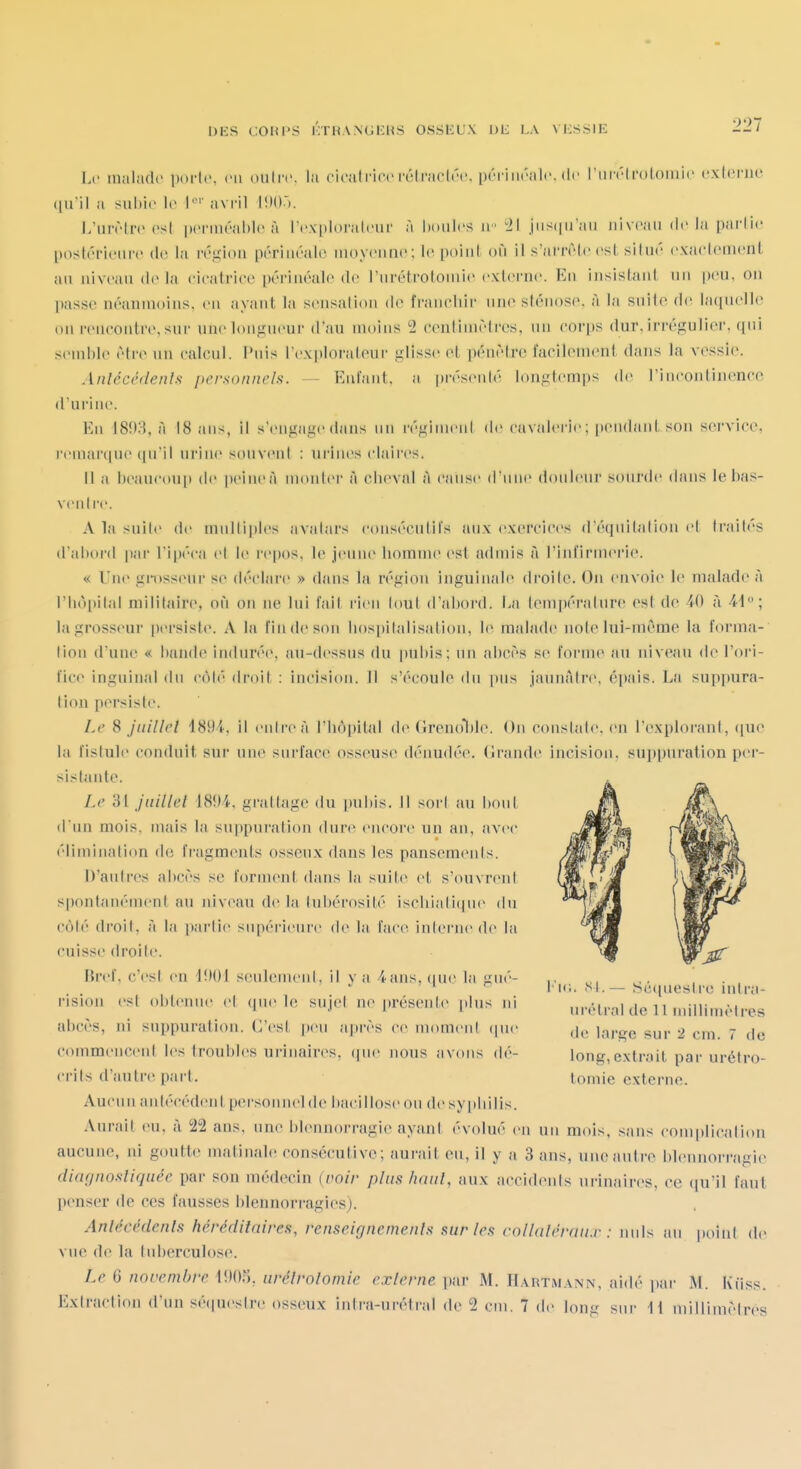 Le in;il;i(l(« ixti'lc, m ouliv. lii cicali-ifc ivli-arlrc. ix'-riiiriilc. de l'iiivli'otoiiiic cxlcriio (|iril a suhic l(> h'' avi'il !!)()'). L'iiivlrc csl pcniH-alilc à IVxploralciu' à Ixuilcs ii ^21 jiis(|iraii niveau de la partie liostérieiire de la ré.u'ion périaéale inoyeiuie; le poiiil où il s'anvie est, silué exaclemenl au iiiveaii delà eiealrice périaéale de riirétroloiuie externe. En insistant nii peu, on passe néanmoins, en ayant la sensation de franeliii' une sténose, à la snile de laquelle on rencontre, sur une longueur d'au moins 2 cenlimètres, un corps dur, irrégulier, ([ni semble être un calcul. Puis rex])lorateur glisse et pénètre facilement dans la vessie. Anlécédenlft jx'rsonnels. — Enfant, a présenté longtemps de rineonlinencc d'urine. En J8!);^, à 18 ans, il s'engage dans un régiment de cavalerie; pendant son service, remarcpie (|u'il urine souveni : urines claires. tl a i)eaucoup de [)eineà monter à cheval à cause d'nne douleur soni'de dans le bas- ventre. A la snile de multiples avatars consécutifs aux exercices d'équilation cl Irailés d'abord par l'ipéca et le repos, le jenne homme est admis à l'infirmerie. « Une gn)ssenr se déclare » dans la région inguinale droilc. On envoie le malade à l'hôpilal militaire, on on ne lui l'ail rien hmt d'aboi'd. \a\ lempéralure est de 40 à. 44; la grosseur persiste. A la findeson hospil.alisation, le malade note lui-même la forma- lion d'une « bande indurée, au-dessus du pubis; un abcès se forme au niveau de l'or-i- fice inguinal du côté droit : incision. 11 s'écoule du pus jaunâtre, épais. La suppura- tion persiste. Le 8 juillel 1891. il entre à l'hôpital de Greno*l)le. On constate, en l'exploi-ant, ([ue la lislule conduit sur une surface osseuse déimdée. (irande incision, suppuration per- sistante. Le 31 juillel 18f)4. grattage du pubis. 11 soi'l au bout d'un mois, mais la suppuration dure encore un an, avec élimination de fi'agments osseux dans les pansemenis. D'autres abcès se forment dans la suite et s'ouvrent s|)ontanémenl au niveau de la luhérosité ischiali(jue du côté droit, à la [lartie supérieure de la face interne de la cuisse droite. Mref, c'est en 4001 seulement, il va 4ans, (|ue la gué- rision est obtenue et (pie le sujet ne présente plus ni abcès, ni suppuration. C'est peu après ce momeni (|ue commencent les troubles urinaires, (pic nous avons (b'- crits d'autre pai't. Aucun antécéd(!nt personnel de bacillose ou desy|(bilis. Aurait eu, à 22 ans, une blennorragie ayant évolué en un mois, sans complication aucune, ni g(3utte matinale con,sccntive; aurait eu, il y a 3 ans, une autre bl(>nnorragie diarinoxliquéc par son médecin (voir plus luiul, aux accidents urinaires, ce (lu'il faut penser de ces fausses blennorragies). Anlécédenls héréditaires, renseigncmenls sur les collatéraux : nuls au point de viH^ de la fid)erculose. Le 6 novembre 4!)()5, iirélrolomic externe par M. Hartmann, aidé par Kiiss. Exiraclion d'un s('(|uestre osseux intra-unHral de 2 cm. 7 de long sur 41 millimètres l'io. SI.— S(i([uesli'c inlra- urélral de 11 millimèlres de large sur 2 cm. 7 de long,extrait par uréfro- tomie externe.