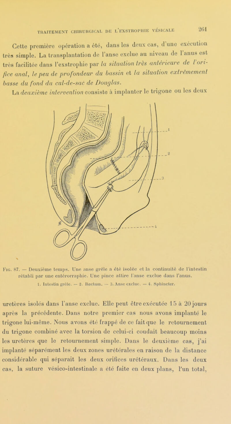 Cette première opération a été, dans les deux cas, d une exécution très simple. La transplantation de l'anse exclue au niveau de l'anus est très facilitée dans l'exstrophie par la silaalion très antérieure de Vori- fice anal, le peu de profondeur du bassin et la siluation exlrêmemenl basse du fond du cul-de-sac de Douglas. La deuxième intervention consiste à implanter le trigone ou les deux FiG. 87. — Deuxième temps. Une anse gi'èle a été isolée et la continuité de l'intestin rétabli par une entcrorrapliie. Une pince attire l'anse exclue dans l'anus. 1. Intestin grêle. — 2. lîecluin. — 3. Anse c.vcluc. — 4. Sphincter. uretères isolés dans l'anse exclue. Elle peut être exécutée 15 à 20 jours après la précédente. Dans notre premier cas nous avons implanté le trigone lui-même. Nous avons été frappé de ce fait que le retournement du trigone combiné avec la torsion de celui-ci coudait beaucoup moins les uretères que le retournement simple. Dans le deuxième cas, j'ai implanté séparément les deux zones urétérales en raison de lu distance considérable qui séparait les deux orifices urétéraux. Dans les deux cas, la suture vésico-intestinale a été faite en deux plans, l'un total,