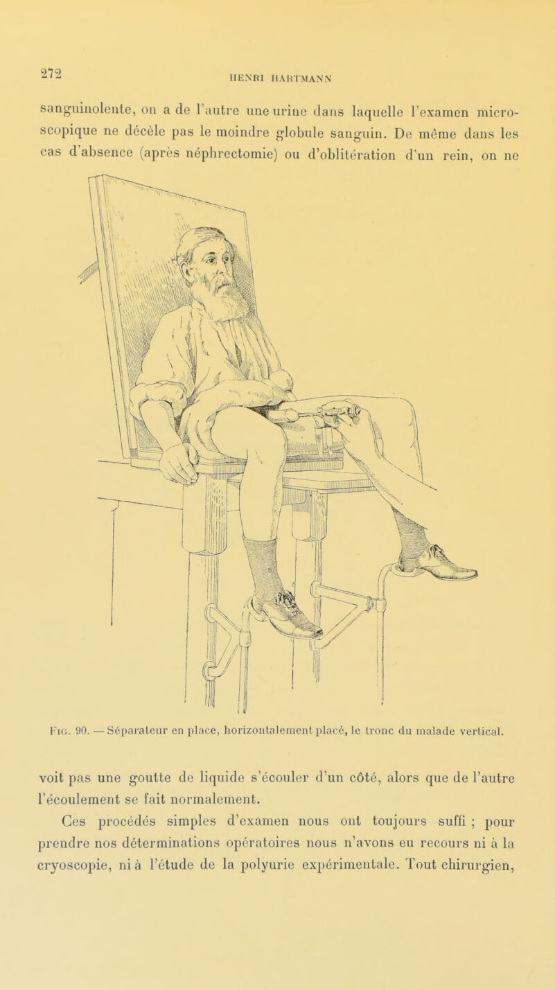 HENRI llAliTMANN sanguinolente, on a de l'autre une urine dans laquelle l'examen micro- scopique ne décèle pas le moindre globule sanguin. De même dans les cas d'absence (après néplirectomie) ou d'oblitération d'un rein, on ne Fir.. 90. — Séparateur en place, horizontalement placé, le tronc du malade vertical. voit pas une goutte de liquide s'écouler d'un côté, alors que de l'autre l'écoulement se fait normalement. Ces procédés simples d'examen nous ont toujours suffi ; pour prendre nos déterminations opératoires nous n'avons eu recours ni à la cryoscopie, nia l'étude de la polyurie expérimentale. Tout chirurgien,