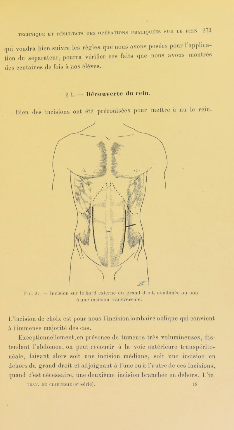 qui voudra bien suivre les règles que nous avons posées pour l'applica- tion du séparateur, pourra vérifier ces faits que nous avons montrés des centaines de fois à nos élèves. 1. _ Découverte du rein. Bien des incisions ont été préconisées i)Our mettre à nu le rein. '.11. — Incision nui le bord externe du yivuid diuil, cond)inôe ou non M uno incision lransvers;de. L'incision de choix est pour nous l'incision lombaire oblique qui convient à l'immense majorité des cas. Exceptionnellement, en présence do tumeurs très volumineuses, dis- tendant l'abdomen, on peut recourir à la voie antérieure transpérito- néale, faisant alors soit une incision médiane, soit une incision en dehors du grand droit et adjoignant à l'une ou à l'autre de ces incisions, quand c'est nécessaire, une deuxième incision branchée en dehors. L'in Tiî.vv. DE CMiiujnGii; (4''série). 18