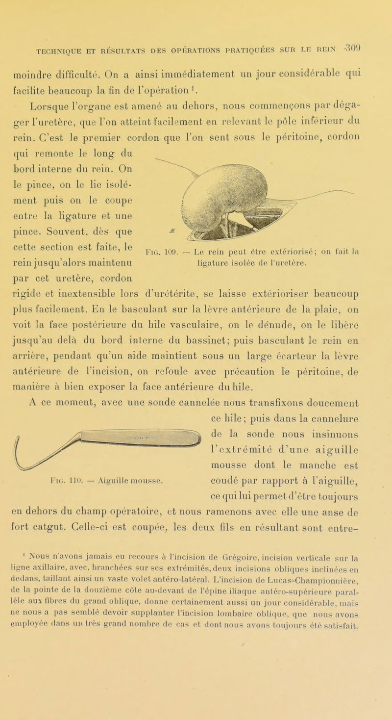 moindre difficulté. On a ainsi immédiatement un jour considérable qui facilite beaucoup la fin de l'opération ^. Lorsque l'organe est amené au dehors, nous commençons par déga- ger l'uretère, que l'on atteint facilement en relevant le pôle inférieur du rein. C'est le premier cordon que l'on sent sous le péritoine, cordon qui remonte le long du bord interne du rein. On le pince, on le lie isolé- ment puis on le coupe entre la ligature et une pince. Souvent, dès que cette section est faite, le rein jusqu'alors maintenu par cet uretère, cordon rigide et inextensible lors d'urétérite, se laisse extérioriser beaucoup plus facilement. En le basculant sur la lèvre antérieure de la plaie, on voit la face postérieure du hile vasculaire, on le dénude, on le libère jusqu'au delà du bord interne du bassinet; puis basculant le rein en arrière, pendant qu'un aide maintient sous un large écarteur la lèvre antérieure de l'incision, on refoule avec précaution le péritoine, de manière cà bien exposer la face antérieure du hile. A ce moment, avec une sonde cannelée nous transfîxons doucement ce hile ; puis dans la cannelure de la sonde nous insinuons Fio. 109. — Le rein peut être extériorisé; on fait la ligature isolée de l urelère. Vu., lit). Aiguille mousse. l'extrémité d'une aie-uille mousse dont le manche est coudé par rapport à l'aiguille, ce qui lui permet d'être toujours en dehors du champ opératoire, et nous ramenons avec elle une anse de fort catgut. Celle-ci est coupée, les deux fils en résultant sont entre- ' Nous n'avons jamais eu recours à l'incision de Grégoire, incision verticale sur la ligne axillaire, avec, branchées sur ses extrémités, deux incisions obliques inclinées en dedans, taillant ainsi un vaste volet antéro-latéral. L'incision de Lucas-Championnière, de la pointe de la douzième cote au-devant de l'épine iliaque antéro-supérieure paral- lèle aux fibres du grand oblique, donne certainement aussi un jour considérable, mais ne nous a pas semblé devoir supplanter l'incision lombaire oblique, que nous avons employée dans un très grand nombre de cas et dont nous avons toujours été satisfait.