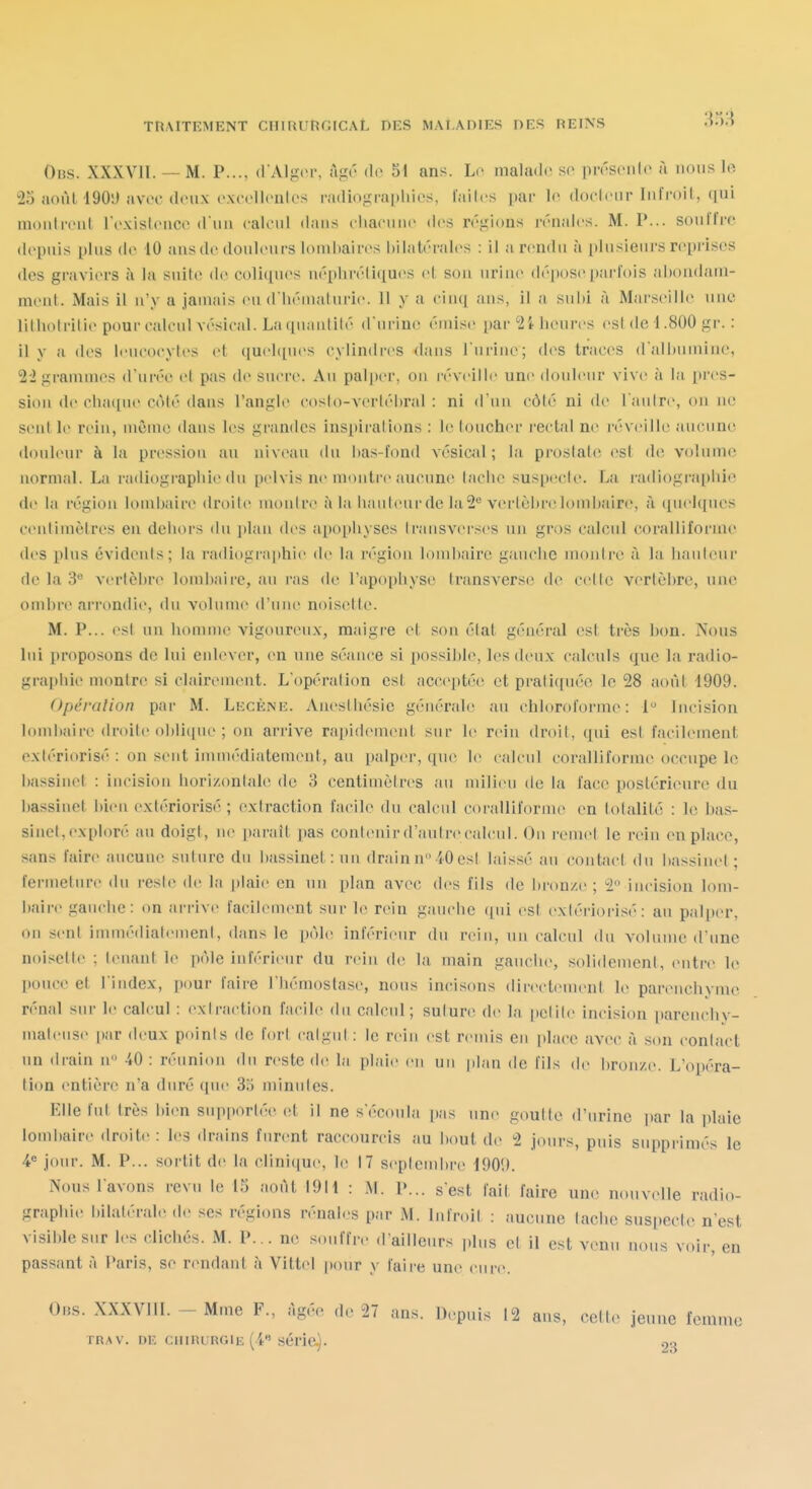 3o3 Obs. XXXVII. — M. P..., (l'Alger, Tigr do 51 ans. Lo malade se pirscnlc à nous le 25 aoùl 1901) aviT doux excellentes radi<)gi-ai>Uies, lailes par le. docleiir Infroil, qui niDiil relit l'existence dun calcul dans chacune des régions rénales. M. P... son lire depuis plus de 10 ans do douleurs lonihairos bilatérales : il a rendu à plusieurs reprises des graviers à la suite de coli(pies néplirétiqu(>s et son urine dépose[tarlois aliondam- nieul. Mais il n'y a jauiais eu d'iiéuialurie. H y a eiuci aus, il a subi à Marseille une lilbotritie pour calcul vésical. La (in;uitilé d urine émise par lionres est de 1.800 gr. : il y a dos loucocytos et quehjuos cylindres dans l'urine; des traces d'albumine, '2'2 grainmos d'urée et pas do sucre. Au palper, on réveille une douleur vive à la pres- sion de cha([uo côté dans l'angle costo-vertébral : ni d'un côté ni de l'autre, on no sentie rein, même dans les grandes inspirations : le toucher rectal ne réveille aucune douleur à la pression au niveau du bas-fond vésical; la pi'oslate est dci volume normal. La radiographie du pelvis ne montre aucune tache susix'cle. La, radiographie de la région lomljairo droite montre à la liaulenr de laS*^ vertèbrelombaire, à ([uelqncs cenlimètres en dehors du plan des apophyses traiisverses un gros calcul corallifornie des plus évidents; la radiograi)hie de la région lombaire gauche monlre à la hauteur de la S** vertèbre lombaire, an ras de l'apophyse transverse de cette vertèbre, une ombr(> ai'rondio, du volume d'une noisette. M. P... est un honnne vigoureux, maigi-e et son étal général est très bon. iSons lui proposons de lui enlever, en une séance si possible, les doux calculs que la radio- graphie montre si clairement. L'opération est acceptée et pratiquée le 28 août 1909. Opération par M. Lecèniî. Anosthésic générale au chloroforme: 1 Incision lombaire droite oblique ; on arrive rapid(Mneut sur le rein droit, qui est facilement extériorisé : on sent immédiatement, au palper, que le calent corallifornie occupe le Iiassinet : incision horizontale de 3 centimètres au milieu de la face postérieure du l)assiuct bien extériorisé ; extraction facile du calcul corallifornu' en totalité : le bas- sinet, exploré au doigt, ne parait pas contenir d'autre calcul. On remet le rein en place, sans fair(< aucune suture du bassinet: nu drain n 40 est laissé au contacl du bassimq ; fermeture du reste de la plaie en un plan avec des fils de bronze ; 2 incision lom- baire gauche: on ai-rive facilement sur le rein gauclie ([ui est extériorisé: au palper, ou sent immédiatement, dans le pôle inférieur du rein, un calcul du volume d'une noisette ; louant le pôle inférieur du rein de la main gauche, solidement, entre le pouce et l'index, pour faire l'hémostase, nous incisons directemeni le pareuchvme rénal sur le cah'ul : extraction facile du calcul; suturi^ de la |)ctite incision pareuchy- niateiise par deux points de fort catgut : le rein est remis en place avec à son conlact un drain n 40: réunion du reste do la plaie eu un plan de fils (1(^ bron/.(>. L'opéra- lion entière n'a duré que 35 minules. Elle fui très bien supportée^ et il ne s'écoula i);is une goutte d'urine par la plaie lombaire droite : les drains furent raccourcis au l)out de 2 jours, puis supprimés le 4^ jour. M. P... sortit de la clinique, le 17 septemI)ro 190'.). Nous l'avons revu le 15 août 19H : M. p... s'est fait faire um; nouvelle radio- graphie bilatérale do ses régions rénales par M. Infroit : aucune tache suspecte n'est visible sur les clichés. M. P... ne souffre d'ailleurs plus et il est venu nous voir, en passant à i'aris, se nnulant à Viltel |)our y faire une cur<'. Ons. XXXVllI. - Mme F., Agée de 27 ans. Depuis 12 aus, cette jeune femme ra.w. DE cninuRGiE (4** série.). 9.^