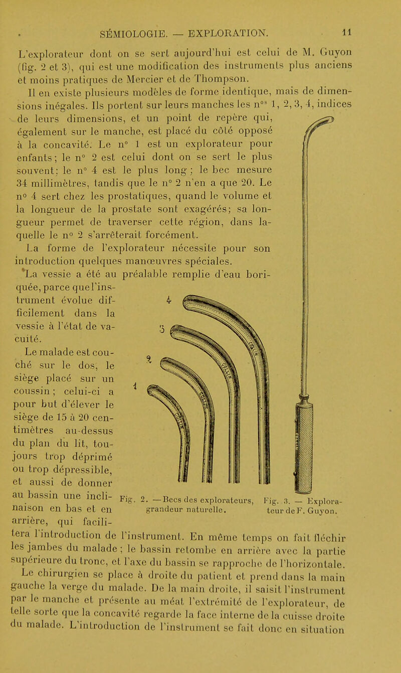 L'explorateur dont on se sert aujourd'hui est celui de M. Guyon (fig. -2 et 3), qui est une modification des instruments plus anciens et moins pratiques de Mercier et de Thompson. Il en existe plusieurs modèles de forme identique, mais de dimen- sions inégales. Ils portent sur leurs manches les n' 1, 2, 3, -i, indices de leurs dimensions, et un point de repère qui, également sur le manche, est placé du côté opposé à la concavité. Le n 1 est un explorateur pour enfants ; le n 2 est celui dont on se sert le plus souvent; le n 4 est le plus long ; le bec mesure 34 millimètres, tandis que le n° 2 n'en a que 20. Le no 4 sert chez les prostatiques, quand le volume et la longueur de la prostate sont exagérés; sa lon- gueur permet de traverser cette région, dans la- quelle le n° 2 s'arrêterait forcément. La forme de l'explorateur nécessite pour son introduction quelques manœuvres spéciales. *La vessie a été au préalable remplie d'eau bori- quée, parce que l'ins- trument évolue dif- 4 fîcilement dans la vessie à l'état de va- cuité. Le malade est cou- ché sur le dos, le siège placé sur un coussin ; celui-ci a pour but d'élever le siège de 15 à 20 cen- timètres au-dessus du plan du lit, tou- jours trop déprimé ou trop dépressible, et aussi de donner au bassin une incli- naison en bas et en arrière, qui facili- tera l'introduction de l'instrument. En même temps on fait lléchir les jambes du malade ; le bassin retombe en arrière avec la partie supérieure du tronc, et l'axe du bassin se rapproche de l'horizontale. Le chirurgien se place à droite du patient et prend dans la main gauche la verge du malade. De la main droite, il saisit l'inslrument par le manche et présente au méat l'extrémité de l'explorateur, de telle sorte que la concavité regarde la face interne delà cuisse droite du malade. L'introduction de l'instrument se fait donc en situation Fis. 2. —Becs des explorateurs, grandeur naturelle. Fig. .3. — Explora- teur de]. Guyon.