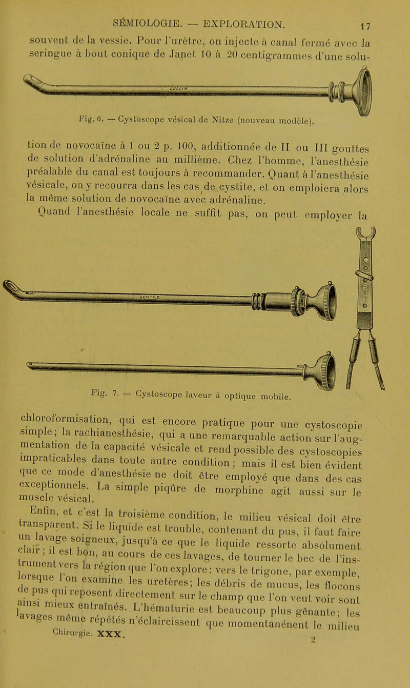 souvent de la vessie. Pour l'urètre, on injecte à canal iermé avec la seringue à bout conique de Janet 10 à 20 centigrammes d'une solu- Fig. 6. — Cystbscope vésical de Nitze (nouveau modèle) tionde novocaïne à 1 ou 2 p. JOO, additionnée de II ou III gouttes de solution d'adrénaline au millième. Chez l'homme, l'auesthésie préalable du canal est toujours à recommander. Quant à l'anesthésie vésicale, on y recourra dans les cas de cystite, et on emploiera alors la même solution de novocaïne avec adrénaline. Quand l'anesthésie locale ne suffit pas, on peut employer la Fig. 7. — Cystoscope laveur à optique mobile. chloroformisation, qui est encore pratique pour une cystoscopie simple; la rachianesthésie, qui a une remarquable action sur l'auo- mentation de la capacité vésicale et rend possible des cystoscopies impraticables dans toute autre condition; mais il est bien évident que ce mode d'anesthésie ne doit être employé que dans des cas exceptionnels La simple piqûre de morphine agit aussi sur le muscle vesical. irn?«!!' '\''c'l ^f- condition, le milieu vésical doit être l an parent. Si le liquide est trouble, contenant du pus, il faut faire cl ir Tl^'M'^''j''^^'^ ^'«ï^i^'^ absolument lrum;n ' 7' ^^^'8^^^' tourner le bec de l'ins- iZue ron 1 °«^Pl°''«^ 1« U-igone, par exemple, orsque Ion examine les uretères; les débris de mucus, les llocon.; le pus qui reposent directement sur le champ que l'on veut voir sont ainsi m.eux entraînés. L'hématurie est beaucoup plus gênant- le Ravages môme répétés n'éclaircissent que momentanénent le .nili''' Chirurgie. XXX.