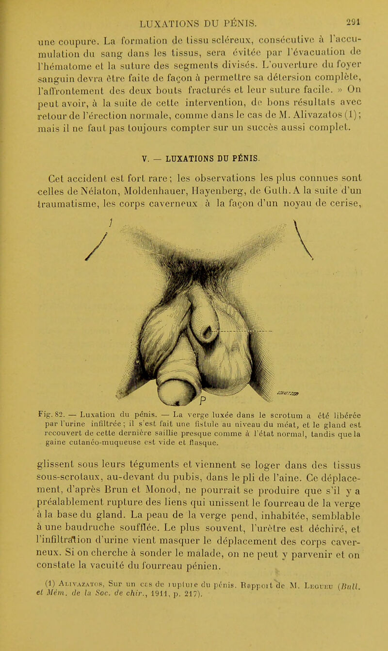 une coupure. La formation de lissu scléreux, consécutive à Taccu- mulalion du sang dans les tissus, sera évitée par l'évacuation de riiémalome el la suture des segments divisés. L'ouverture du foyer sanguin devra cHre faite de fatjon h permettre sa détersion complète, l'atlrontement des deux bouts fracturés et leur suture facile. » On peut avoir, à la suite de cette intervention, de bons résultats avec retour de l'érection normale, comme dans le cas de M. Alivazatos(l); mais il ne faut pas toujours compter sur un succès aussi complet. V. — LUXATIONS DU PÉNIS. Cet accideni est fort rare; les observations les plus connues sont celles deNélaton, Moldenhauer, llayenberg, de Guth.A la suite d'un traumatisme, les corps caverneux à la façon d'un noyau de cerise. Fig-. 82. — Luxation du pénis. — La verge luxée dans le scrotum a été libérée par l'urine infiltrée; il s'est fait une fistule au niveau du méat, et le gland est recouvert de cette dernière saillie presque comme à l'état normal, tandis que la gaine cutanéo-muqiieuse est vide et llasque. glissent sous leurs téguments et viennent se loger dans des tissus sous-scrolaux, au-devant du pubis, dans le pli de l'aine. Ce déplace- ment, d'après Brun et Monod, ne pourrait se produire que s'il y a préalablement rupture des liens qui unissent le fourreau de la verge à la base du gland. La peau de la verge pend, inhabitée, semblable à une baudruche soufflée. Le plus souvent, l'urètre est déchiré, et l'infiltration d'urine vient masquer le déplacement des corps caver- neux. Si on cherche à sonder le malade, on ne peut y parvenir et on constate la vacuité du fourreau pénien. (1) Ai.ivAZATds, Sur un ces de lupliiie du pénis. Uoppoit de M. Li-giku {JittU. el Mém. de la Soc. de chir., 1911, p. 217).