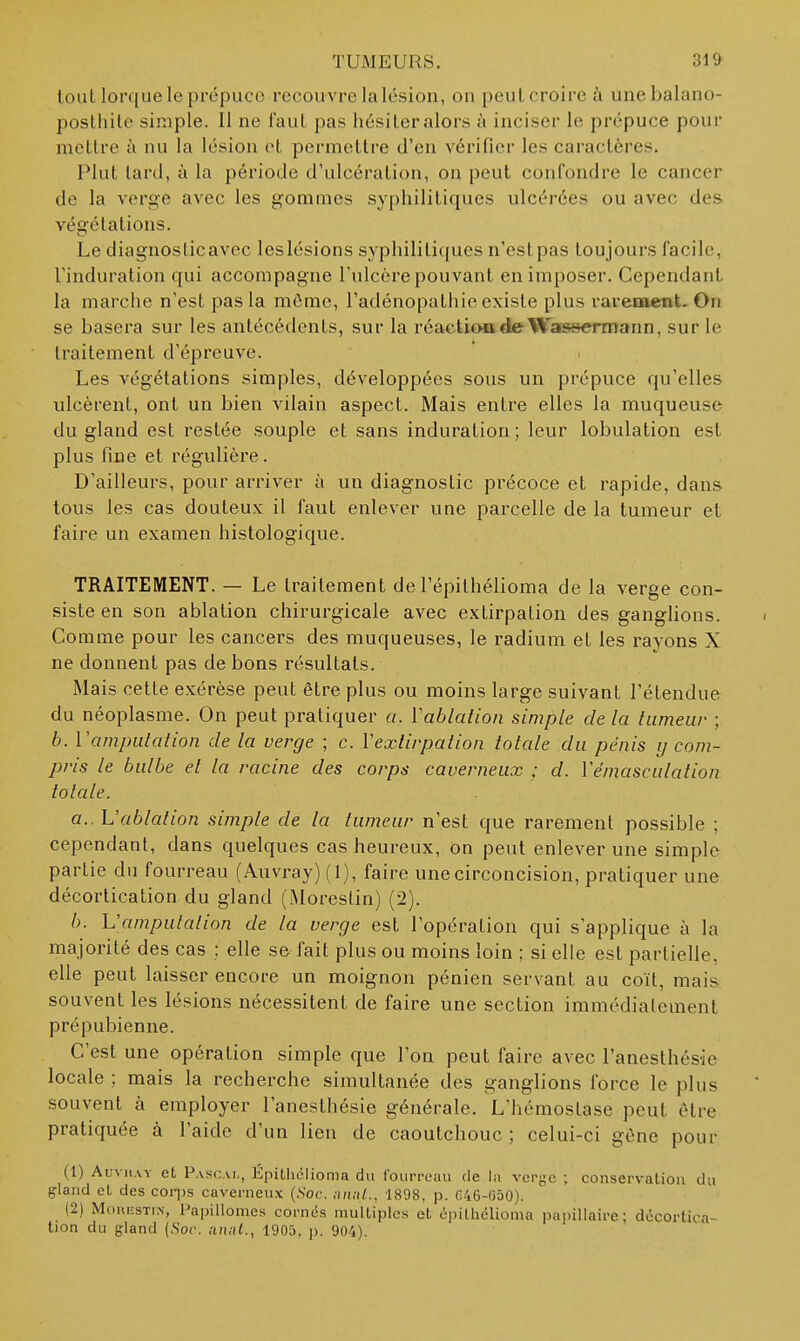 louL lorque le prépuce recouvre la lésion, on peut croire h une balano- posthile simple. 11 ne faut pas hési 1er alors à inciser le prépuce pour mettre à nu la lésion et permettre d'en vérifier les caractères. Plut tard, à la période d'ulcération, on peut confondre le cancer de la verge avec les gommes syphilitiques ulcérées ou avec des végétations. Le diagnosticavec leslésions syphiliti([ues n'estpas toujours facile, l'induration qui accompagne l'ulcère pouvant en imposer. Cependant la marche n'est pas la môme, l'adénopathie existe plus rarement. On se basera sur les antécédents, sur la réactÏMideWassermann, sur le traitement d'épreuve. Les végétations simples, développées sous un prépuce qu'elles ulcèrent, ont un bien vilain aspect. Mais entre elles la muqueuse du gland est restée souple et sans induration ; leur lobulation est plus fine et régulière. D'ailleurs, pour arriver à un diagnostic précoce et rapide, dans tous les cas douteux il faut enlever une parcelle de la tumeur et faire un examen histologique. TRAITEMENT. — Le traitement de l'épilhélioma de la verge con- siste en son ablation chirurgicale avec extirpation des ganglions. Comme pour les cancers des muqueuses, le radium et les rayons X ne donnent pas de bons résultats. Mais cette exérèse peut être plus ou moins large suivant l'étendue du néoplasme. On peut pratiquer a. Vablation simple de la tumeur ; b. l'amputation de la verge ; c. Vextirpation totale du pénis y com- pris le bulbe et la racine des corps caverneux ; d. Vémasculalion totale. a. . L'ablation simple de la tumeur n'est que rarement possible ; cependant, dans quelques cas heureux, On peut enlever une simple partie du fourreau (Auvray) (1), faire une circoncision, pratiquer une décortication du gland (Moreslin) (2). b. L'amputation de la verge est l'opération qui s'applique à la majorité des cas : elle se fait plus ou moins loin ; si elle est partielle, elle peut laisser encore un moignon pénien servant au coït, mais souvent les lésions nécessitent de faire une section immédiaicment pré pubienne. C'est une opération simple que l'on peut faire avec l'anesthésie locale ; mais la recherche simultanée des ganglions force le plus souvent à employer l'anesthésie générale. L'hémostase peut être pratiquée à l'aide d'un lien de caoutchouc ; celui-ci gêne pour (1) AuviiAY et Pascal, Épitliclioma du i'ourreaii de la verge ; conservalion du gland et des coqjs caverneux (Soc. nniil., 1898, p. 646-650). (2) MoHiîSTiN, Papillonies cornés muUiples et cpilhélioma papillaire ; décortica- tion du gland (.Soc. aniit., 1905, p. 904).
