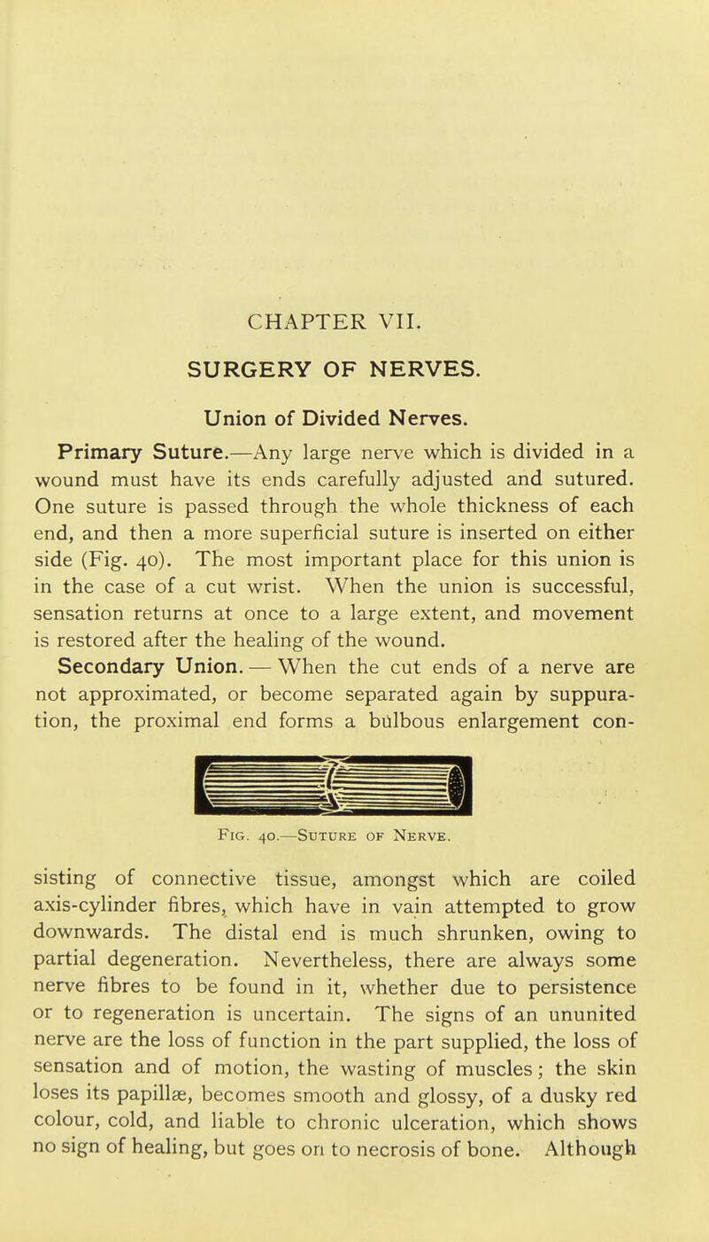 SURGERY OF NERVES. Union of Divided Nerves. Primary Suture.—Any large nerve which is divided in a wound must have its ends carefully adjusted and sutured. One suture is passed through the whole thickness of each end, and then a more superficial suture is inserted on either side (Fig. 40). The most important place for this union is in the case of a cut wrist. When the union is successful, sensation returns at once to a large extent, and movement is restored after the healing of the wound. Secondary Union. — When the cut ends of a nerve are not approximated, or become separated again by suppura- tion, the proximal end forms a bulbous enlargement con- FiG. 40.—Suture of Nerve. sisting of connective tissue, amongst which are coiled axis-cylinder fibres, which have in vain attempted to grow downwards. The distal end is much shrunken, owing to partial degeneration. Nevertheless, there are always some nerve fibres to be found in it, whether due to persistence or to regeneration is uncertain. The signs of an ununited nerve are the loss of function in the part suppHed, the loss of sensation and of motion, the wasting of muscles; the skin loses its papillae, becomes smooth and glossy, of a dusky red colour, cold, and liable to chronic ulceration, which shows no sign of healing, but goes on to necrosis of bone. Although