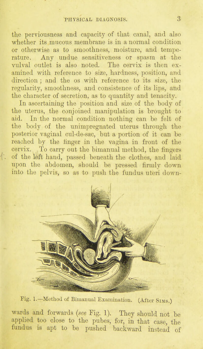 the perviousness and capacity of that canal, and also wliether its mucous membrane is in a normal condition or otherwise as to smoothness, moisture, and tempe- rature. Any undue sensitiveness or spasm at the vulval outlet is also noted. The cervix is then ex- amined Avith reference to size, hardness, position, and direction ; and the os with reference to its size, the regularity, smoothness, and consistence of its lips, and the character of secretion, as to quantitj'' and tenacity. In ascertaining the position and size of the body of the uterus, the conjoined manipulation is brought to aid. In the normal condition nothing can be felt of the body of the unimpregnated uterus through the posterior vaginal cul-de-sac, but a portion of it can be reached by the linger in the vagina in front of the cervix. , To carry out the bimanual method, the fingers of the left hand, passed beneath the clothes, and laid upon the abdomen, should be pressed firmly down into the pelvis, so as to push the fundus uteri down- Fig. 1.—Method of Bimanual Exaniiuatiou. (After Si.\is.) wards and forwards (see Fig. 1). They should not be applied too close to the pubes, for, in that case, the fundus is apt to be pushed backward instead of