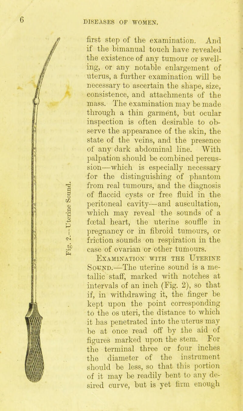 first step of the exaniiiiation. Ami if the bimanual touch have revealed the existence of any tumour or swell- ing, or any notable enlargement of uterus, a further examination will be necessary to ascertain the shape, size, consistence, and attachments of the mass. The examination may be made through a thin garment, but ocular inspection is often desirable to ob- serve the appearance of the skin, the state of the veins, and the presence of any dark abdominal line. With palpation should be combined percus- sion—which is especially necessary for the distingTiishing of phantom from real tumours, and the diagnosis of flaccid cysts or free fluid in the peritoneal cavity—and auscultation, which may reveal the sounds of a foDtal heart, the uterine souffle in pregnancy or in fibroid tumours, or friction sounds on respiration in the case of ovarian or other tumours. Examination with the Uterine Sound.—The uterine sound is a me- tallic staff, marked with notches at intervals of an inch (Fig. 2), so that if, in Avithdrawing it, the finger be kept upon the point corresponding to the OS uteri, the distance to which it has penetrated into the uterus may be at once read off by the aid of figures marked upon the stem. For the terminal three or four inches the diameter of the instrument should be less, so that this portion of it may be readily bent to any de- sired curve, but is yet firm enough