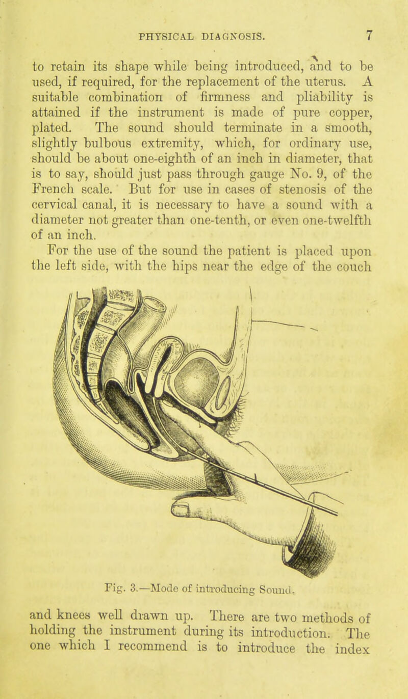 to retain its shape while being introduced, and to be used, if required, for the replacement of the uterus. A suitable combination of firmness and pliability is attained if the instrument is made of pure copper, plated. The sound should terminate in a smooth, slightly bulbous extremity, which, for ordinary use, should be about one-eighth of an inch in diameter, that is to say, should just pass through gauge JSTo. 9, of the French scale. But for use in cases of stenosis of the cervical canal, it is necessary to have a sound with a diameter not greater than one-tenth, or even one-twelfth of an inch. For the use of the sound the patient is placed upon the left side, with the hips near the edge of the couch Fig. 3.—Mode of introducing Sound, and knees well drawn up. There are two methods of holding the instrument during its introduction. The one which I recommend is to introduce the index