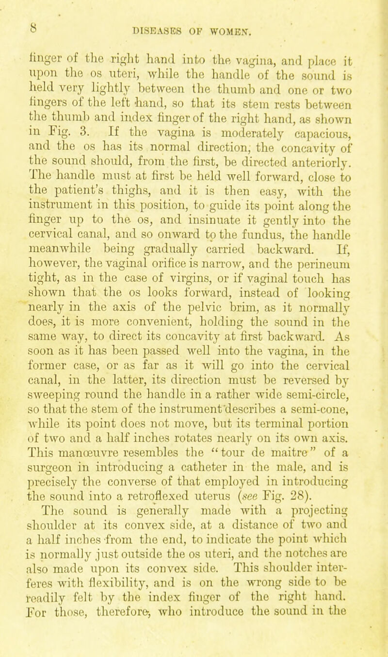 linger of tlie right hand into the vagina, and place it upon the os uteri, while the handle of the sound is held very lightly between the thumb and one or two fingers of the left 'hand, so that its stem rests between the thumb and index finger of the right hand, as shown in Fig. 3. If the vagina is moderately capacious, and the os has its normal direction, the concavity of the sound should, from the first, be directed anteriorly. The handle must at first be held well forward, close to the patient's thighs, and it is then easy, with the instrument in this position, to guide its point along the finger up to the os, and insinuate it gently into the cervical canal, and so onward to the fundus, the handle meanwhile being gradually carried backward. If, however, the vaginal orifice is narrow, aud the perineum tight, as in the case of virgins, or if vaginal touch has shown that the os looks forward, instead of looking nearly in the axis of the pelvic brim, as it normally does, it is more convenient, holding the sound in the same way, to direct its concavity at first backward. As soon as it has been passed well into the vagina, in the former case, or as far as it will go into the cervical canal, in the latter, its direction must be reversed by sweeping round the handle in a rather wide semi-circle, so that the stem of the instrument'describes a semi-cone, Avhile its point does not move, but its terminal portion of two and a half inches rotates nearly on its own axis. This manoeuvre resembles the  tour de maitre  of a surgeon in introducing a catheter in the male, and is precisely the converse of that employed in introducing the sound into a retroflexed uterus {see Fig. 28). The sound is generally made with a projecting shoulder at its convex side, at a distance of two and a half inches from the end, to indicate the point Avhich is normally just outside the os uteri, and the notches are also made upon its convex side. This shoulder inter- feres with flexibility, and is on the wrong side to be readily felt by the index finger of the right hand. For those, therefore-, who introduce the sound in the