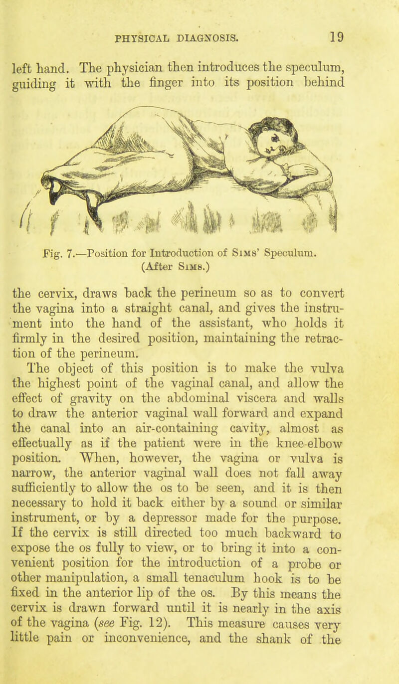 left hand. The physician then introduces the speculum, guiding it with the finger into its position behind Fig. 7.—Position for Introduction of Sims' Speculum. (After Sims.) the cervix, draws back the perineum so as to convert the vagina into a straight canal, and gives the instru- ment into the hand of the assistant, who holds it firmly in the desired position, maintaining the retrac- tion of the perineum. The object of this position is to make the vulva the highest point of the vaginal canal, and allow the effect of gravity on the abdominal viscera and walls to draw the anterior vaginal wall forward and expand the canal into an air-containing cavity, almost as effectually as if the patient were in the knee-elbow position. When, however, the vagina or vulva is narrow, the anterior vaginal wall does not fall away sufficiently to allow the os to be seen, and it is then necessary to hold it back either by a sound or similar instrument, or by a depressor made for the purpose. If the cervix is still directed too much backward to expose the os fully to view, or to bring it into a con- venient position for the introduction of a probe or other manipulation, a small tenaculum hook is to be fixed in the anterior lip of the os. By this means the cervix is drawn forward until it is nearly in the axis of the vagina {see Fig. 12). This measure causes very little pain or inconvenience, and the shank of the