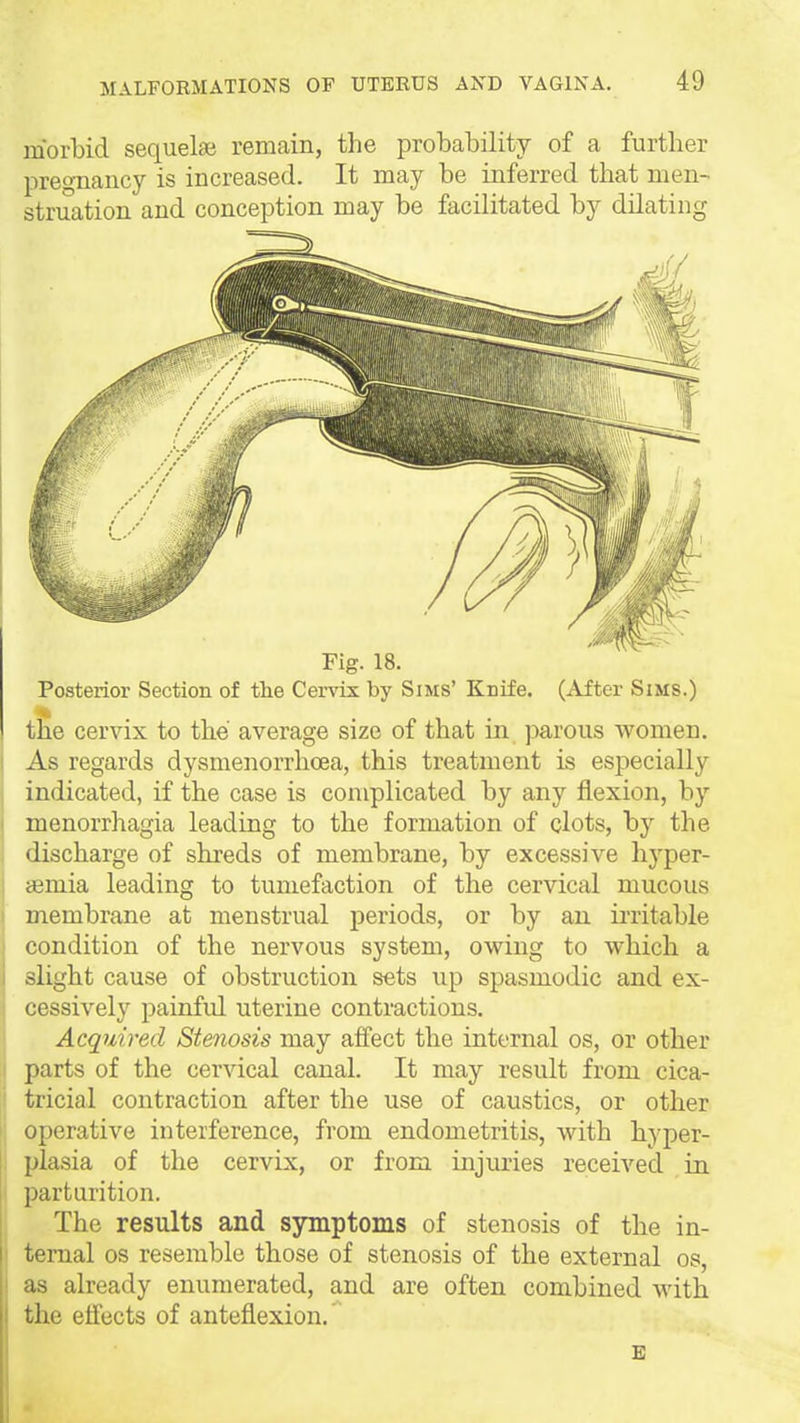 morbid sequelae remain, the probability of a further pregnancy is increased. It may be inferred that men- struation and conception may be facilitated by dilating Fig. 18. Posterior Section of tlie Cervix by Sims' Knife. (After Sims.) the cervix to the average size of that in ]Darous women. As regards dysmenorrhoea, this treatment is especially indicated, if the case is coiTiplicated by any flexion, by menorrhagia leading to the formation of clots, by the discharge of shreds of membrane, by excessive hyper- semia leading to tumefaction of the cervical mucous membrane at menstrual periods, or by an ii-ritable condition of the nervous system, owing to which a slight cause of obstruction sets up spasmodic and ex- cessively painful uterine contractions. Acquired Stenosis may affect the internal os, or other parts of the cervical canal. It may result from cica- tricial contraction after the use of caustics, or other operative interference, from endometritis, with hyper- plasia of the cervix, or from injuries received in parturition. The results and symptoms of stenosis of the in- ternal OS resemble those of stenosis of the external os, as already enumerated, and are often combined with the effects of anteflexion.' E