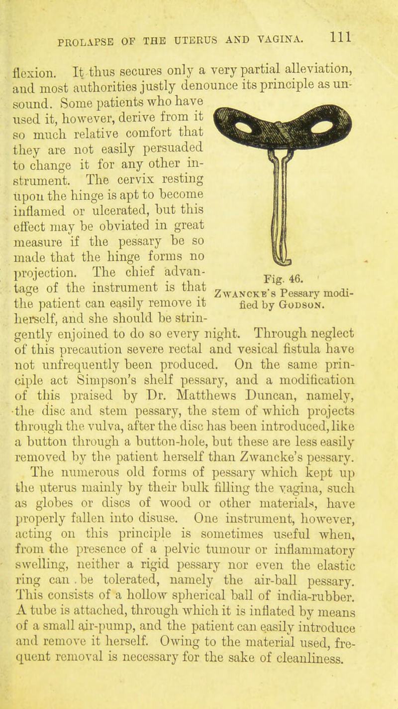 flexion. It thus secures only a very partial alleviation, and most authorities justly denounce its principle as un- sound. Some patients who have used it, however, derive from it so much relative comfort that they are not easily persuaded to change it for any other in- strument. The cervix resting upon the hinge is apt to become inflamed or ulcerated, hut this effect may be obviated in great measure if the pessary be so made that the hinge forms no proiection. The chief advan- tage of the instrument is that z^vanckes Pessary modi- the patient can easily remove it fied by Godson. herself, and she should be strin- gently enjoined to do so every night. Through neglect of this precaution severe rectal and vesical fistula have not unfrequently been produced. On the same prin- ciple act Simpson's shelf pessary, and a moditication of this praised by Dr. Matthews Duncan, namely, ■the disc and stem pessary, the stem of which projects through the vulva, after the disc has been introduced, like a button through a button-hole, but these are less easily removed by the patient herself than Zwancke's pessary. The numerous old forms of pessary which kept up the uterus mainly by their bulk filling the vagina, such as globes or discs of wood or other materials, have properly fallen into disuse. One instrument, however, acting on this principle is sometimes useful when, from the presence of a pelvic tumour or inflammatory swelling, neither a rigid pessary nor even the elastic ring can . be tolerated, namely the air-baU pessary. This consists of a hollow spherical ball of india-rubber. A tube is attached, through which it is inflated by means of a small air-juimp, and the patient can easily introduce and remove it herself. Owing to the material used, fre- quent removal is necessary for the sake of cleanliness.