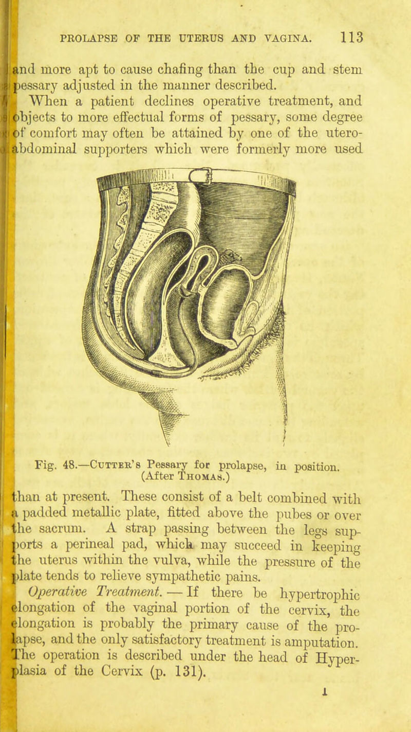 nd more apt to cause chafing than the cup and stem ■ossary adjusted in the manner described. When a patient declines operative treatment, and bjects to more effectual forms of pessary, some degree if comfort may often be attained by one of the utero- abdominal supporters which were formerly more used Fig. 48. -Cutter's Pessaiy for prolapse, in position. (After Thomas.) lUan at present. These consist of a belt combined with ;i padded metallic plate, fitted above the pubes or over the sacrum. A strap passing between the legs sup- ports a perineal pad, whick may succeed in keepin the uterus within the vulva, while the pressure of the j)late tends to relieve sympathetic pains. Operative Treatment. — If there be hypertrophic elongation of the vaginal portion of the cervix, the elongation is probably the primary cause of the pro- lapse, and the only satisfactory treatment is amputation. The operation is described under the head of Hyper- plasia of the Cervix (p. 131).