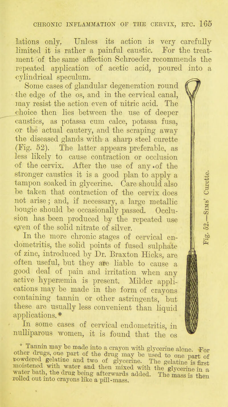 lations only. Unless its action is very carefully limited it is rather a painful caustic. For the treat- ment of the same affection Schroeder recommends the repeated application of acetic acid, poured into a cylindrical speculum. Soine cases of glandular degeneration round • the edge of the os, and in the cervical canal, ]aay resist the action even of nitric acid. The choice then lies between the use of deeper caustics, as potassa cum calce, potassa fusa, or the actual cautery, and the scraping away the diseased glands with a sharp steel curette (Fig. 52). The latter appears preferable, as less likely to cause contraction or occlusion of the cervix. After the use of any .of the stronger caustics it is a good plan to apply a tampon soaked in glycerine. Care should also be taken that contraction of the cervix does not arise; and, if necessary, a large metallic bougie should be occasionally passed. Occlu- <^ven of the solid nitrate of silver. In the more chronic stages of cervical en- dometritis, the solid points of fused sxilphate of zinc, introduced by Dr. Braxton Hicks, arei often useful, but they are liable to cause a good deal of pain and irritation when any active hypera?,mia is present. Milder appli- cations may be made in the form of crayons containing tannin or other astringents, but these are usually less convenient than liquid applications. * In some cases of cervical endometritis, in nulliparous women, it is found that the os * Tannin may be made into a crayon with glycerine alone For other clriigs one part of the di-ng may be used to one part of powdered gelatine and two of glycerine. The gelatine is first moistened with water and then mixed with the glycerine ^ l water bath, the dmg being afterwards added. The mass is then rolled out into crayons like a pill-mass. 0) o