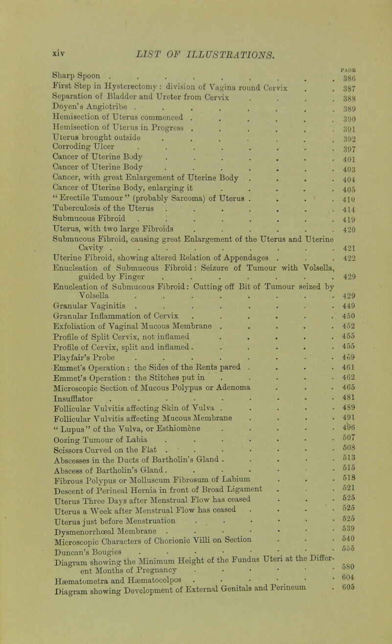 Sharp Spoon . . . , . . . 38(3 First Step in Hysterectomy : division of Vagina round Cervix . . 387 Separation of Bladder and Ureter from Cervix . . . 388 Doyen's Angiotribe ...... 389 Hcmisection of Uterus commenced . . , gon Hemisection of Uterus in Progress .... . ;;'.> I Uterus brought outside .... . 392 Corroding Ulcer ........ 397 Cancer of Uterine Body . . . . . , .401 Cancer of Uterine Body ....... 403 Cancer, with great Enlargement of Uterine Body .... 404 Cancer of Uterine Body, enlarging it ..... 405  Erectile Tumour (probably Sarcoma) of Uterus . . . '• .410 Tuberculosis of the Uterus . . . . . . .414 Submucous Fibroid . . . . . . . .419 Uterus, with two large Fibroids . . . . . .420 Submucous Fibroid, causing great Enlargement of the Uterus and Uterine Cavity ......... 421 Uterine Fibroid, showing altered Relation of Appendages . . . 422 Enucleation of Submucous Fibroid : Seizure of Tumour with Volsella, guided by Finger ....... 429 Enucleation of Submucous Fibroid: Cutting off Bit of Tumour seized by Volsella . . . . . . . .429 Granular Vaginitis ........ 449 Granular Inflammation of Cervix ...... 450 Exfoliation of Vaginal Mucous Membrane ..... 452 Profile of Split Cervix, not inflamed . . . . .455 Profile of Cervix, split and inflamed ...... 455 Playfair's Probe ........ 459 Emmet's Operation : the Sides of the Rents pared . . . .461 Emmet's Operation: the Stitches put in . . . • 462 Microscopic Section of Mucous Polypus or Adenoma . . . 465 Insufflator . . • • • • • . . 481 Follicular Vulvitis affecting Skin of Vulva ..... 489 Follicular Vulvitis affecting Mucous Membrane . . - .491  Lupus  of the Vulva, or Esthiomene ..... 496 Oozing Tumour of Labia . . . • • • .507 Scissors Curved on the Flat ....... 608 Abscesses in the Ducts of Bartholin's Gland . . . • .613 Abscess of Bartholin's Gland. . . . • .615 Fibrous Polypus or Molluscum Fibrosum of Labium . . .518 Descent of Perineal Hernia in front of Broad Ligament . . .521 Uterus Three Days after Menstrual Flow has ceased . . 525 Uterus a Week after Menstrual Flow has ceased . . • .525 Uterus just before Menstruation . t • • • .525 Dysmenorrhceal Membrane . . • • • • .539 Microscopic Characters of Chorionic Villi on Section . . .640 Duncan's Bougies . . • • • • * 1 000 Diagram showing the Minimum Height of the Fundus Uteri at the Differ- ent Months of Pregnancy . • • • • • JbU Hjematometra and Haematocolpos . Diagram showing Development of External Genitals and Perineum . 605