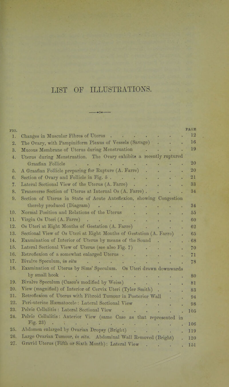 LIST OF ILLUSTEATIONS. FIG. 1. Changes in Muscular Fibres of Utenis 12 2. The Ovary, with Pampiniform Plexus of Vessels (Savage) . . .16 3. Mucous Membrane of Uterus during Menstruation . . . .19 4. Uterus during Menstruation. The Ovary exhibits a recently ruptured Graafian Follicle 20 5. A Graafian Follicle preparing for Rupture (A. Farre) .... 20 6. Section of Ovary and Follicle in Fig. 5 ' . 21 7. Lateral Sectional View of the Uterus (A. Farre) ..... 33 8. Transverse Section of Uterus at Internal Os (A. Farre) .... 34 9. Section of Uterus in State of Acute Anteflexion, showing Congestion thereby produced (Diagram) ........ 34 I. 0. Normal Position and Relations of the Uterus ..... 55 II. Virgin Os Uteri (A. Farre) 60 12. Os Uteri at Eight Months of Gestation (A. Farre) . , . .62 13. Sectional View of Os Uteri at Eight Months of Gestation (A. Farro) . 65 14. Examination of Interior of Uterus by means of the Sound . . . 68 15. Lateral Sectional View of Uterus (see also Fig. 7) .... 70 16. Retroflexion of a somewhat enlarged Uterus 71 17. Bivalve Speculum, in situ ......... 78 18. Examination of Uterus by Sims' Speculum. Os Uteri drawn downwards by small hook ........... 80 19. Bivalve Speculum (Cusco's modified by Weiss) 81 20. View (magnified) of Interior of Cervix Uteri (Tyler Smith) ... 83 21. Retroflexion of Uterus with Fibroid Tumour in Posterior Wall . . 94 22. Peri-uterine Haematocclc: Lateral Sectional View .... 98 23. Pelvic Cellulitis : Lateral Sectional View 105 24. Pelvic Cellulitis: Anterior View (same Case as that represented in Fig-23) 106 25. Abdomen enlarged by Ovarian Dropsy (Bright) 119 26. Large Ovarian Tumour, i?? Abdominal Wall Removed (Bright) . 120 27. Gravid Uterus (Fifth or Sixlh Month): Lateral View . . . .151