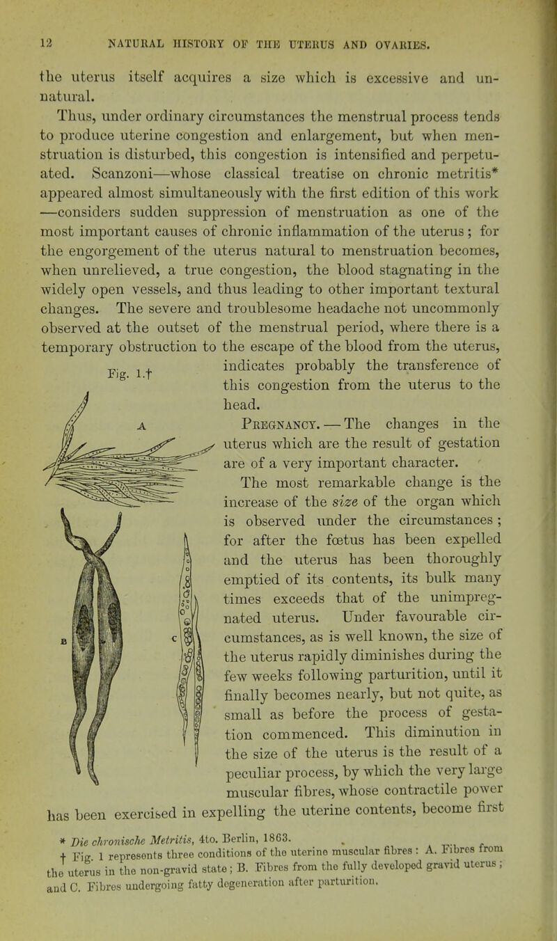 Fig. l.t the uterus itself acquires a size which is excessive and un- natural. Thus, under ordinary circumstances the menstrual process tends to produce uterine congestion and enlargement, but when men- struation is disturbed, this congestion is intensified and perpetu- ated. Scanzoni—whose classical treatise on chronic metritis* appeared almost simultaneously with the first edition of this work —considers sudden suppression of menstruation as one of tlie most important causes of chronic inflammation of the uterus; for the engorgement of the uterus natural to menstruation becomes, when unrelieved, a true congestion, the blood stagnating in the widely open vessels, and thus leading to other important textural changes. The severe and troublesome headache not uncommonly observed at the outset of the menstrual period, where there is a temporary obstruction to the escape of the blood from the uterus, indicates probably the transference of this congestion from the uterus to the head. Pregnancy. — The changes in the uterus which are the result of gestation are of a very important character. The most remarkable change is the increase of the size of the organ which is observed under the circumstances; for after the foetus has been expelled and the uterus has been thoroughly emptied of its contents, its bulk many times exceeds that of the unimpreg- nated uterus. Under favourable cir- cumstances, as is well known, the size of the uterus rapidly diminishes during the few weeks following partm-ition, until it finally becomes nearly, but not quite, as small as before the process of gesta- tion commenced. This diminution in the size of the uterus is the result of a peculiar process, by which the very large muscular fibres, whose contractile power has been exercised in expelling the uterine contents, become first * Die chronische Metritis, 4to. Berlin, 1863. ^ + Fig 1 represents three conditions of the uterine muscular fibres : A. Fibres Irom the uterus in the non-gravid state; B. Fibres from tlie fully developed gravid uterus ; and C. Fibres undergoing fatty degeneration after parturition. 9